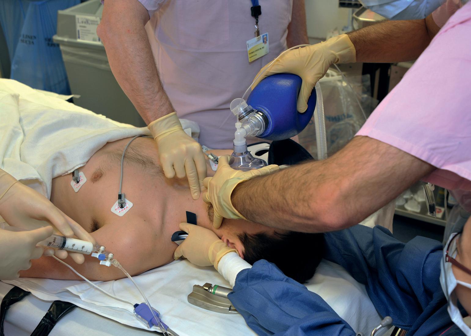 Fig. 34.1, Rapid sequence induction and intubation integrating manual in-line stabilization of cervical spine, application of cricoid pressure, preoxygenation, and administration of induction agents.