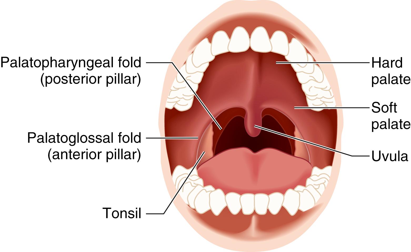 Fig. 44.5, Oral cavity and oropharynx.
