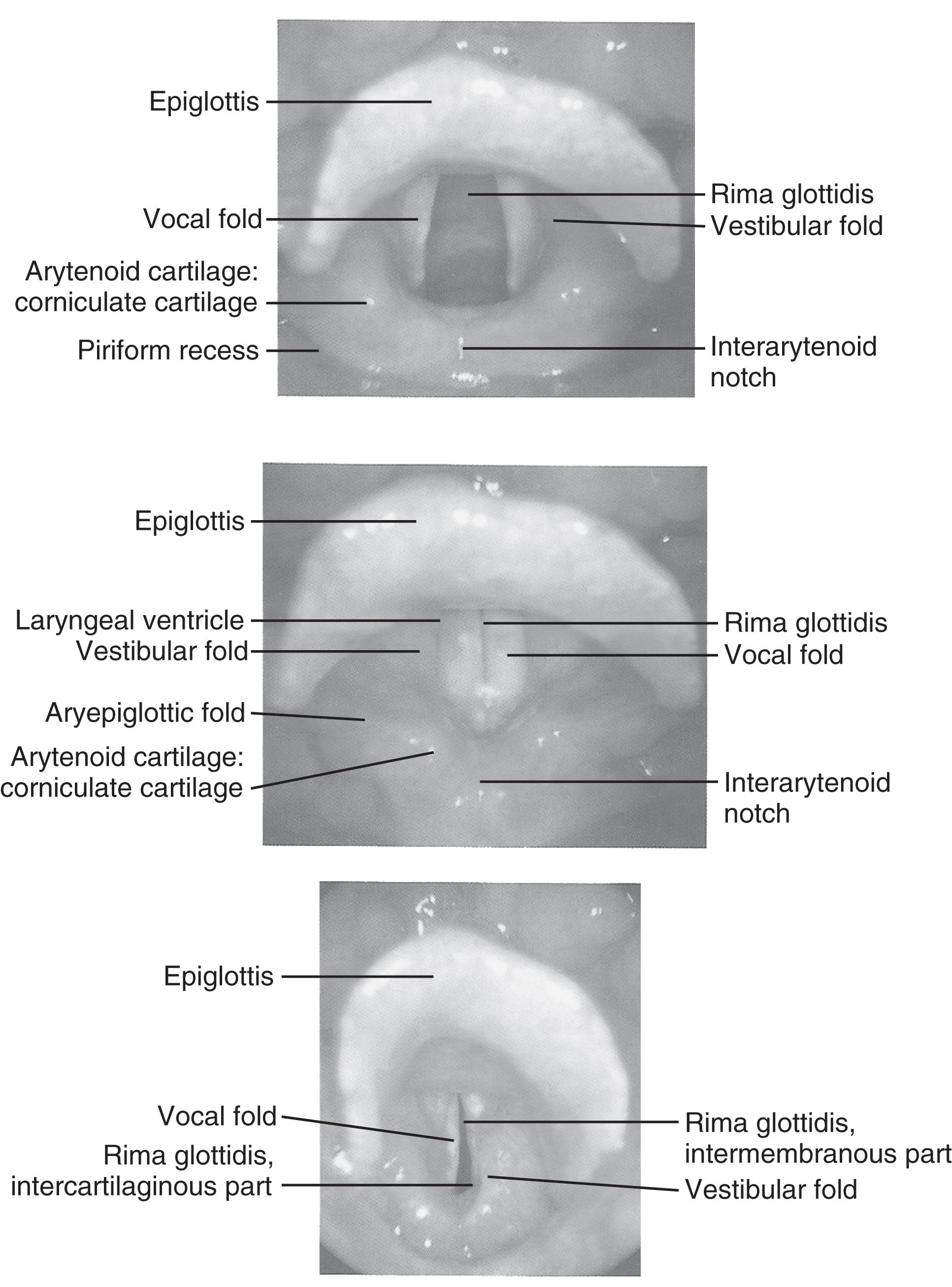 FIGURE 5, Landmarks of the tracheal opening.