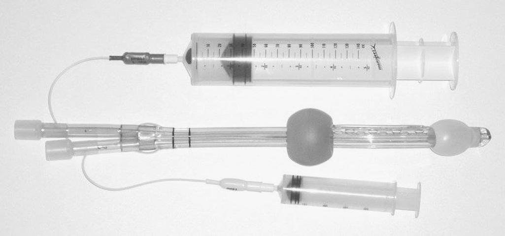 FIGURE 7, Combitube with both balloons inflated. Larger syringe inflates the blue tube (No. 1) balloon.