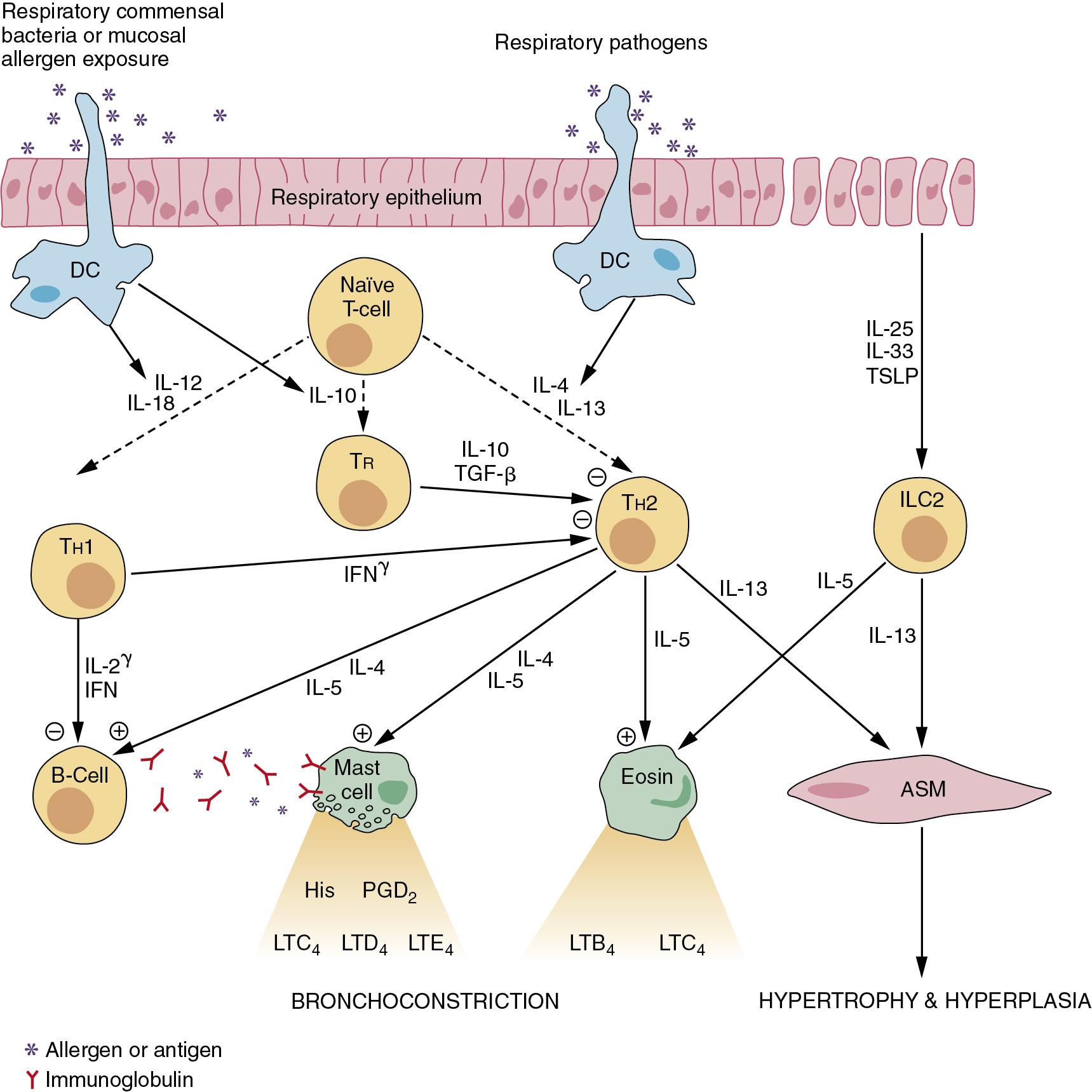 • Fig. 28.2, Inflammatory cells involved in the pathogenesis of allergic asthma, and the main cytokines by which they communicate with each other. For details see text. The immune pathways shown are based on a combination of animal and human studies. IL-25 and IL-33 are released when airway epithelium is damaged, as shown on the right of the figure. ASM , Airway smooth muscle cell; B-cell , B-lymphocyte; DC , dendritic (antigen-presenting) cell; Eosin , eosinophil; ILC2 , natural type-2 helper cell; IL , interleukin; IFN , interferon; Th2 and Th1 , subtypes of T-lymphocyte helper cells; TGF , transforming growth factor; Treg , regulatory lymphocyte; TSLP , thymic stromal lymphopoietin.