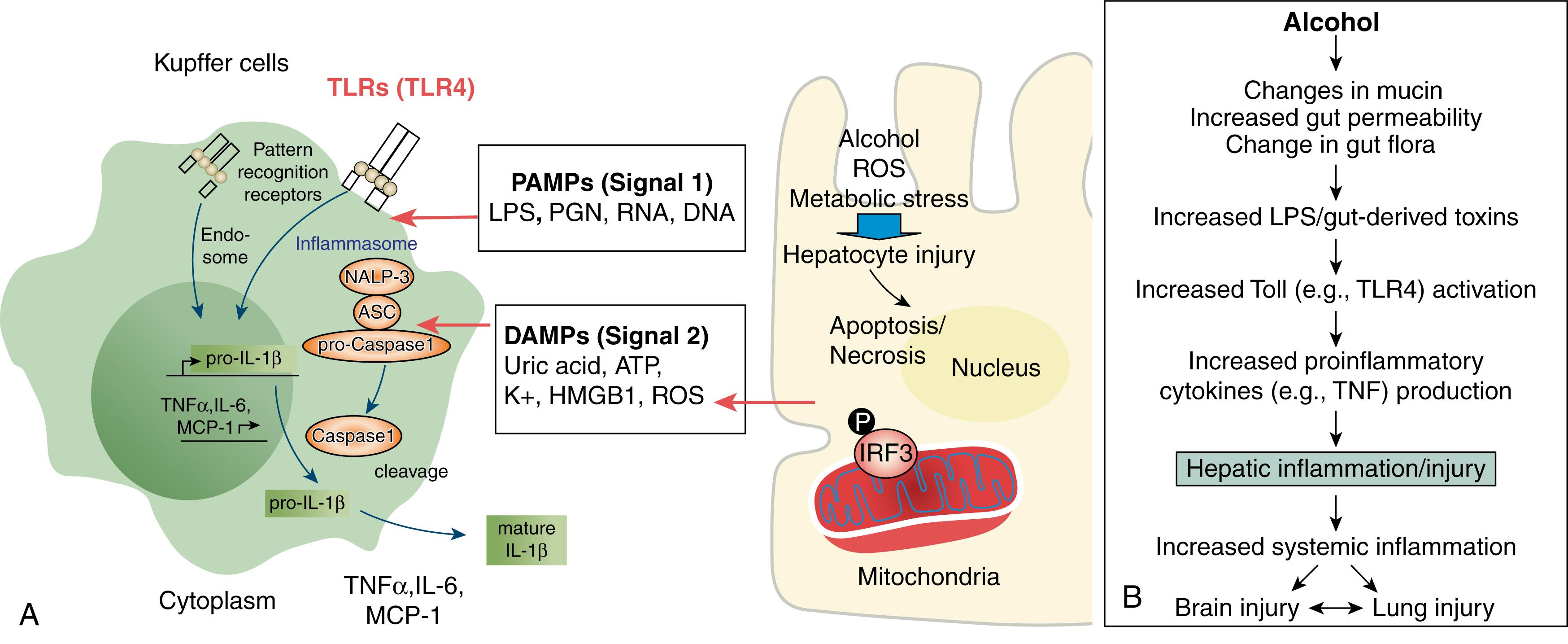 Fig. 86.4, The gut-liver axis. A, Under certain circumstances, gut-derived pathogen-associated molecular patterns ( PAMPs ), including lipopolysaccharide ( LPS ), lipopeptides, unmethylated DNA, double-stranded RNA, and others, translocate from the gut into the portal vein and to the liver, where they are recognized by specific recognition receptors, the Toll-like receptors ( TLRs ), resulting in initiation of the innate immune response, production of inflammatory mediators, activation of inflammasomes, and subsequent liver injury. Alcohol-injured hepatocytes also release damage-associated molecular patterns (DAMPs), such as uric acid, ATP, K+, HMGB1, and ROS, and represent a second signal that further activates inflammasomes. B, Alcohol alters gut-barrier function, thereby promoting bacteria and LPS translocation, TLR activation, cytokine production, liver injury, and potentially other organ injury, including brain inflammation, which may stimulate further alcohol consumption. See text for further details. ASC, apoptosis-associated speck-like protein; HMGB1, high mobility group box 1 ; IL, interleukin; IRF3, interferon regulatory factor 3; MCP-1 , monocyte chemoattractant protein-1; NALP-3, NACHT, LRR, and PYD domains-containing protein; PGN, peptidoglycans; ROS, reactive oxygen species.