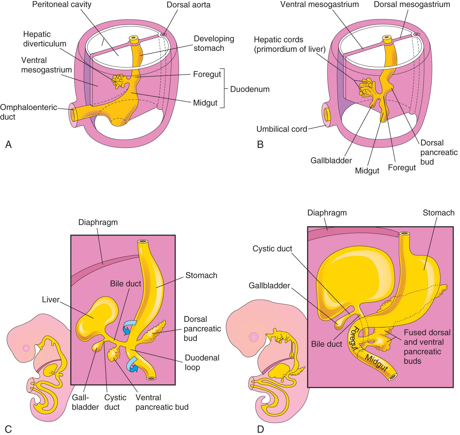 Fig. 11.5, Progressive stages in the development of the duodenum, liver, pancreas, and extrahepatic biliary apparatus. A , Embryo of 4 weeks. B and C , Embryo of 5 weeks. D , Embryo of 6 weeks. During embryologic development, the dorsal and ventral pancreatic buds eventually fuse, forming the pancreas. Note that the entrance of the bile duct into the duodenum gradually shifts from its initial position to a posterior one. This explains why the bile duct in adults passes posterior to the duodenum and the head of the pancreas.