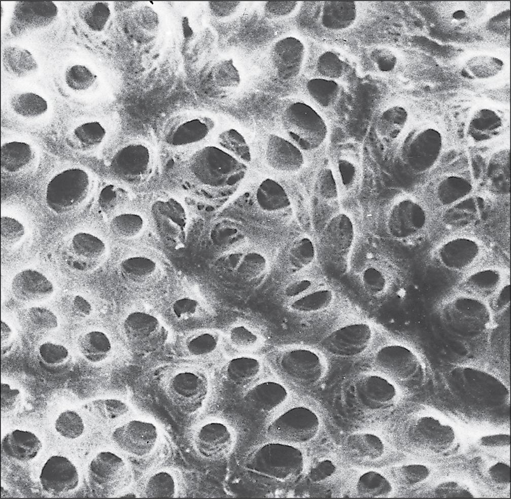 Fig. 11.11, Dentinal Tubules.