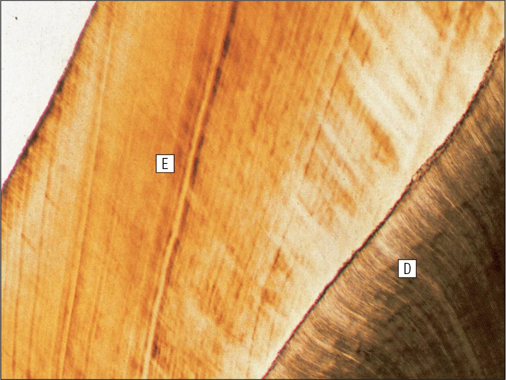 Fig. 11.14, Formed Enamel.