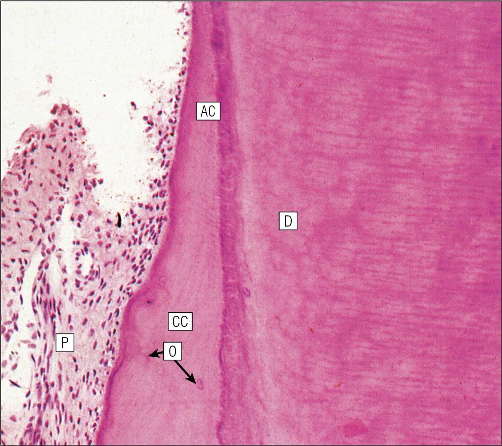 Fig. 11.15, Cementum.