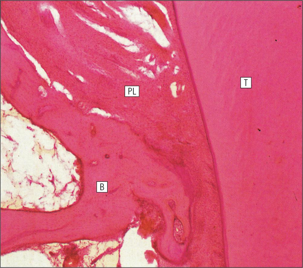 Fig. 11.16, Periodontal Ligament.