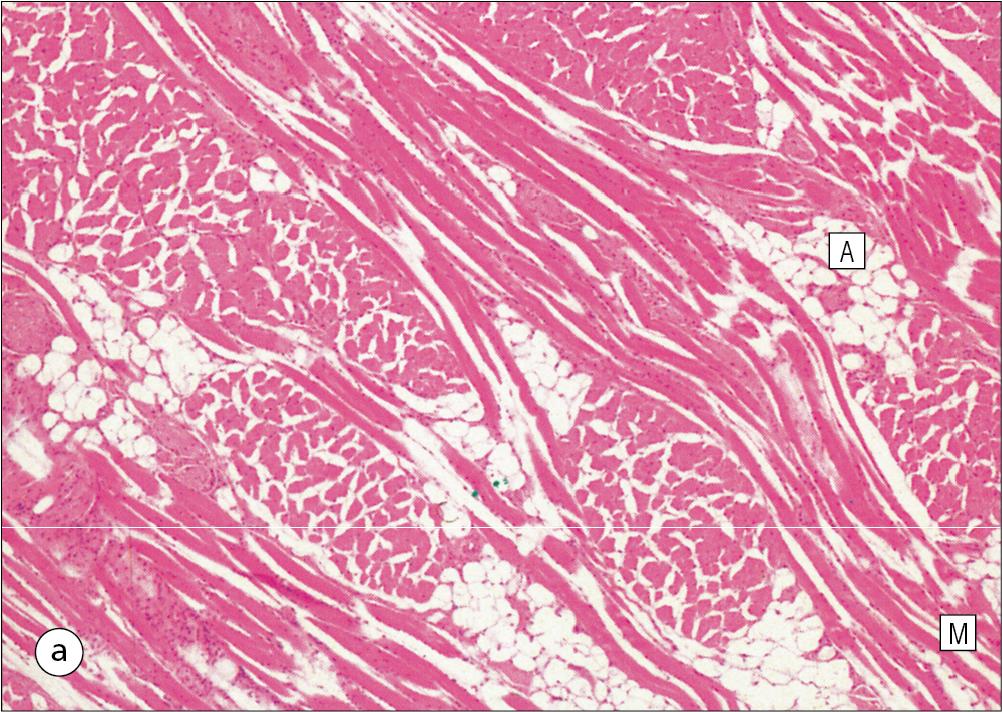 Fig. 11.7, Musculature of the Tongue.