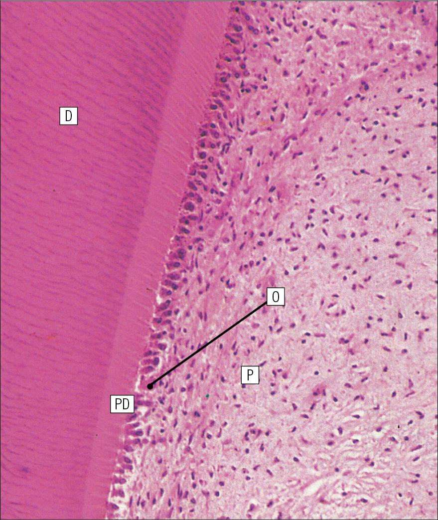 Fig. 11.9, Dentine, Predentine and Odontoblasts.