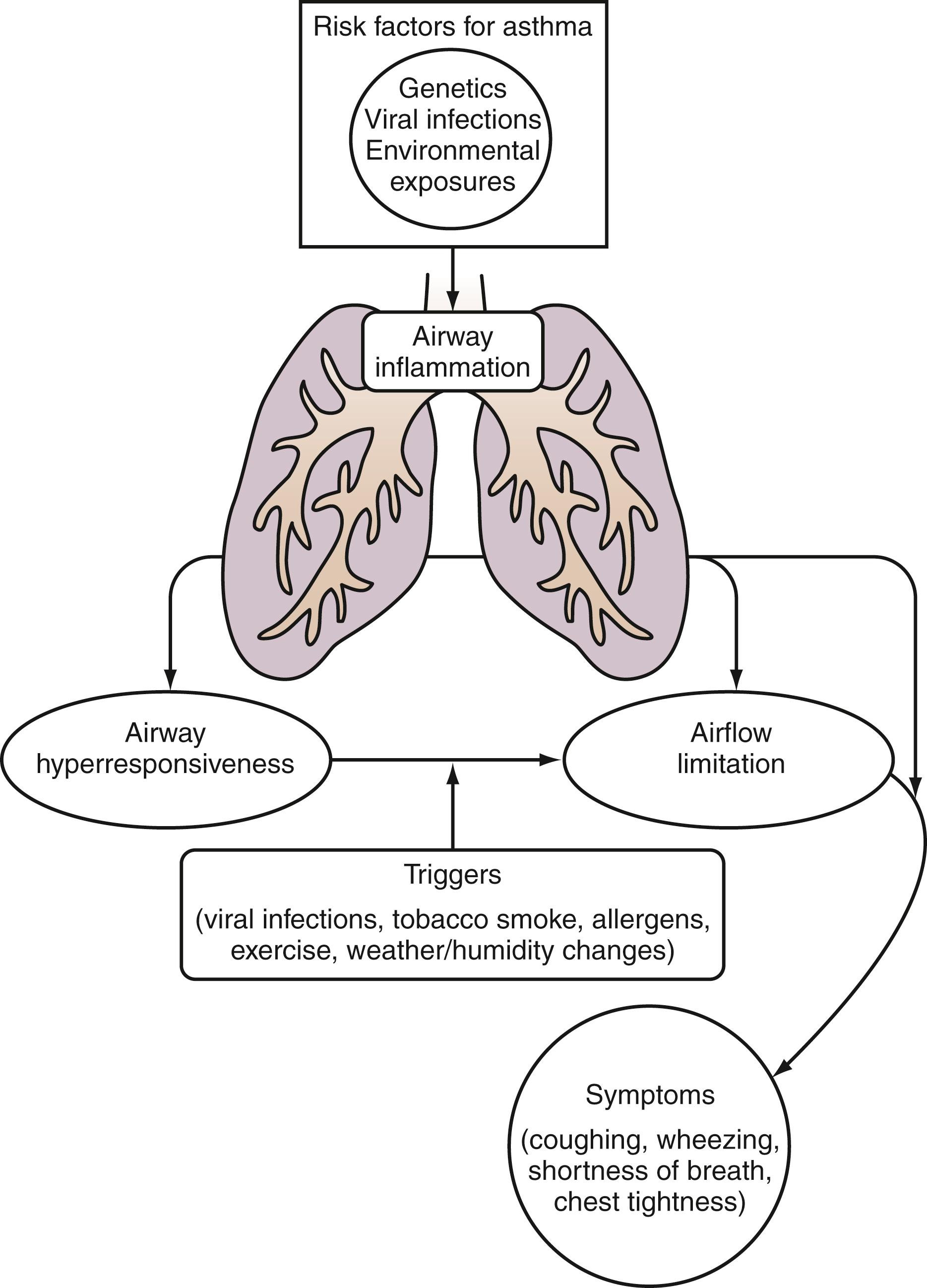 Fig. 4.18, An interaction between genetic and environmental factors is involved in the pathogenesis of asthma.