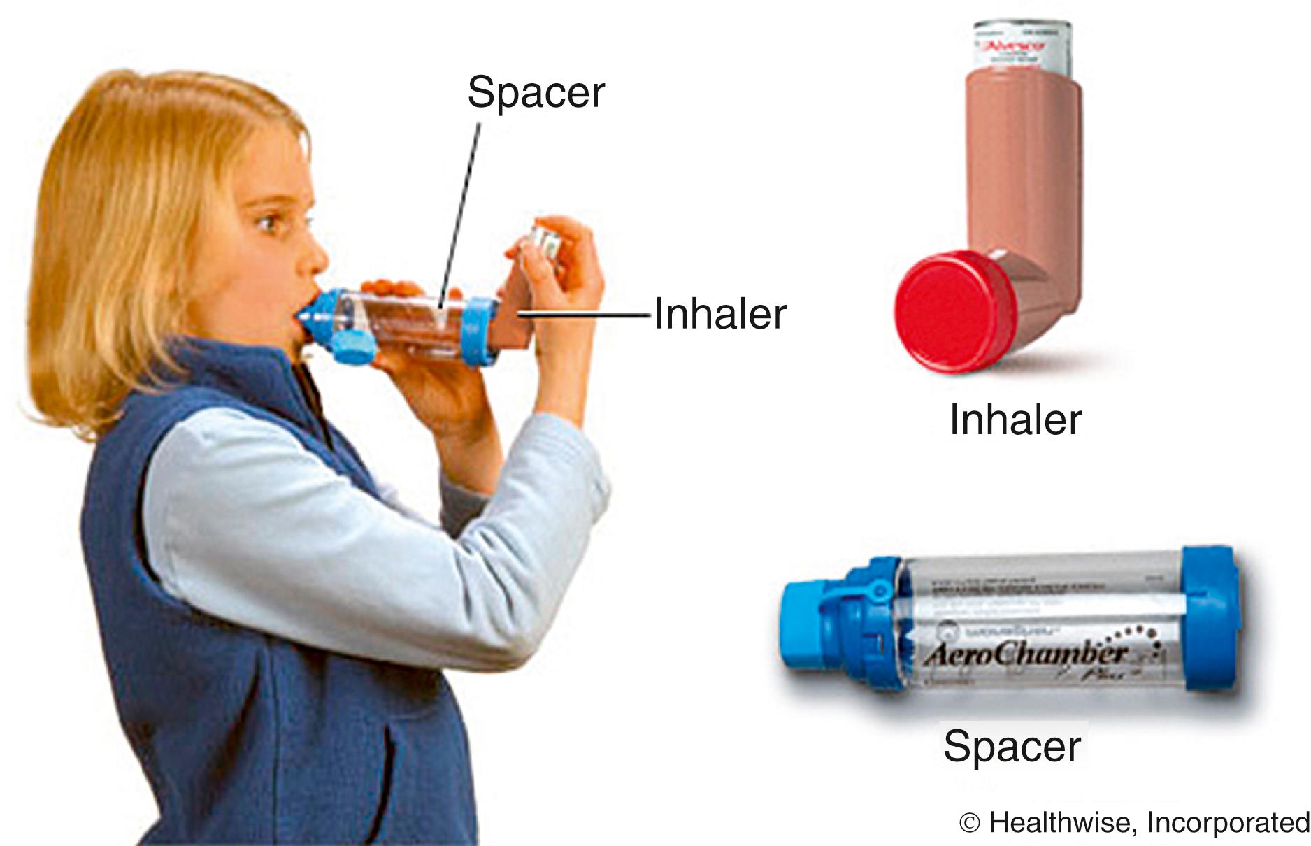 Fig. 4.22, Proper metered dose inhaler technique.