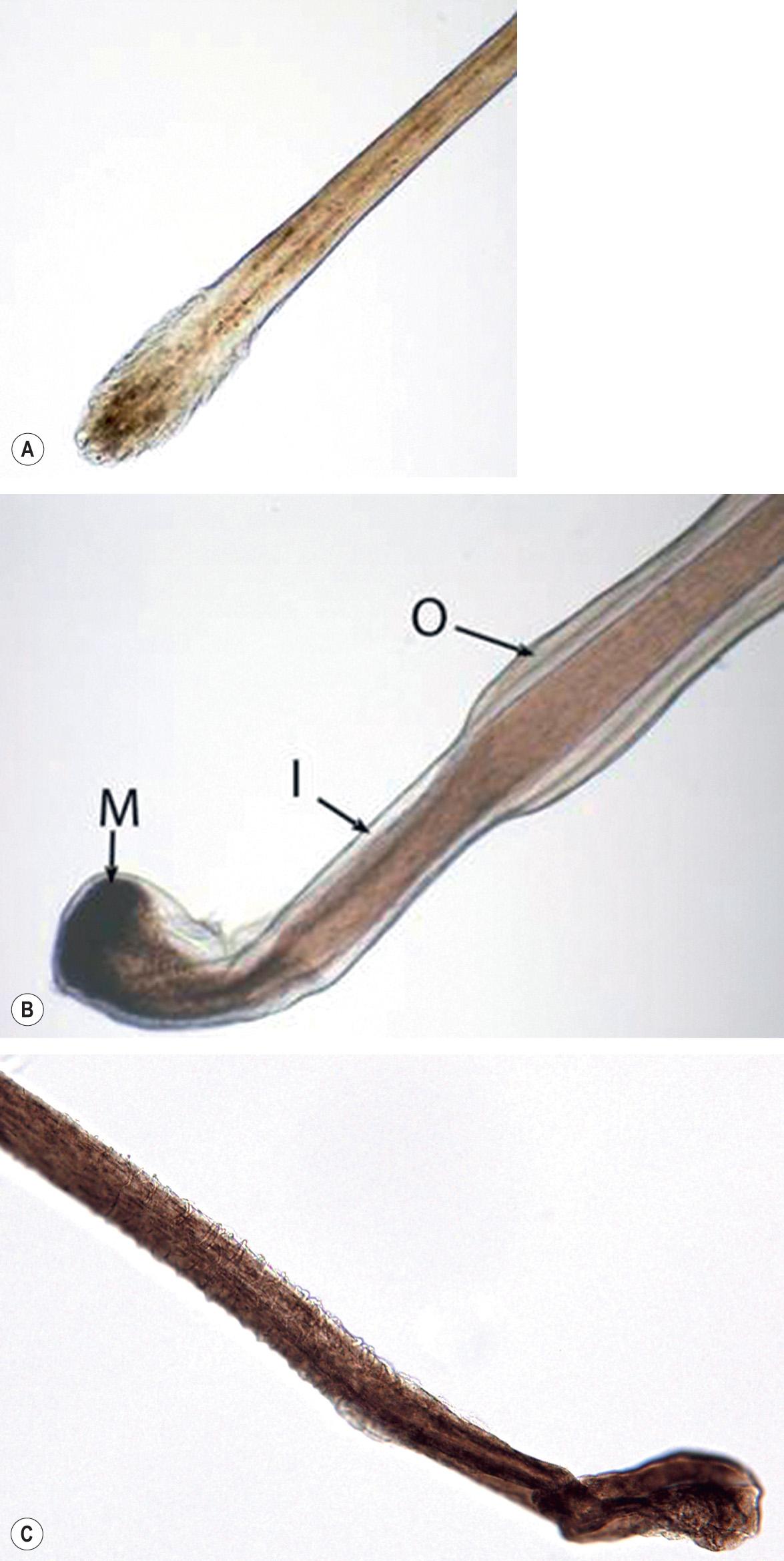 Fig. 69.12, Microscopic features of anagen and telogen hairs.