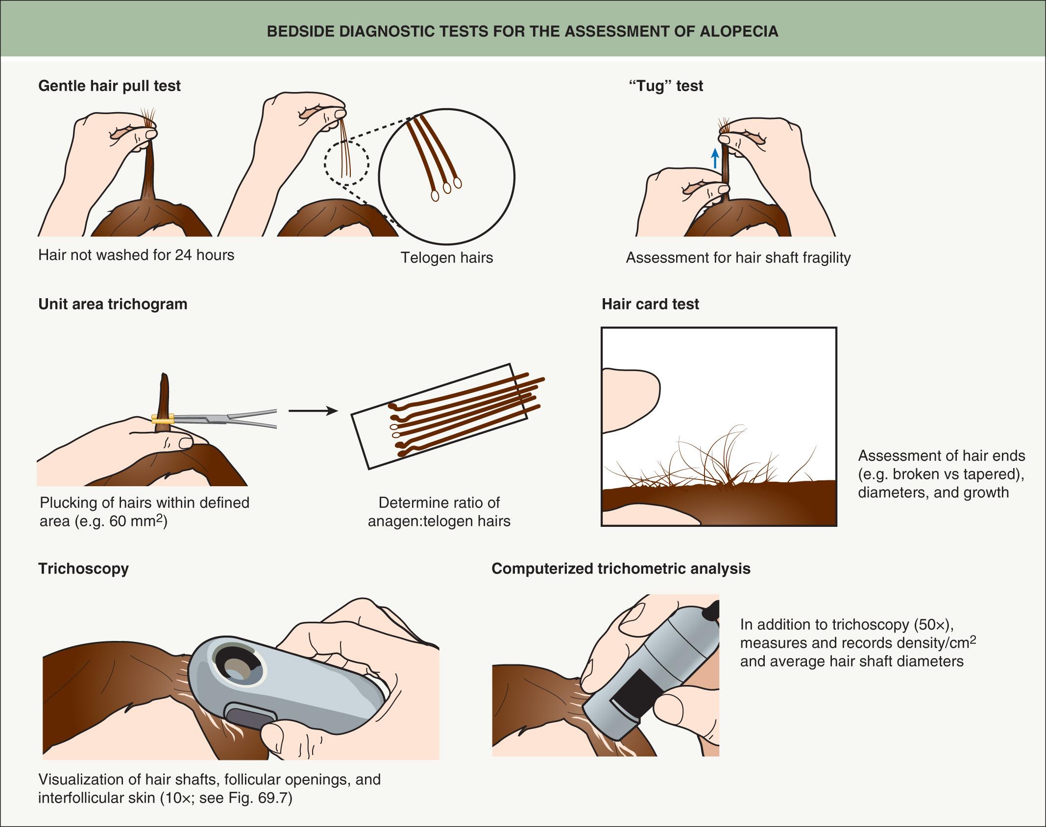 Fig. 69.2, Bedside diagnostic tests for the assessment of alopecia.