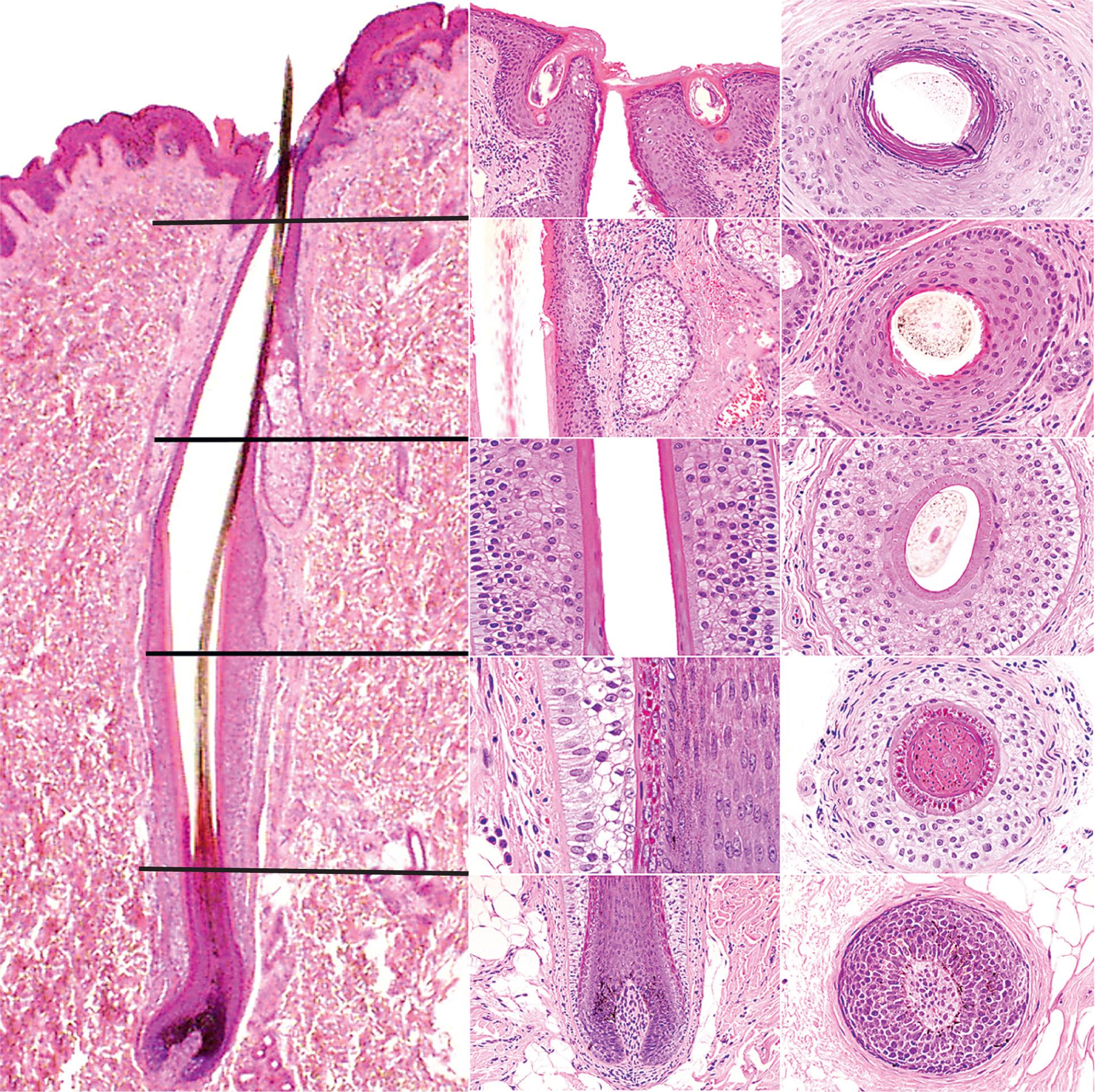 Fig. 69.8, Vertical and horizontal sections of a hair follicle cut at different levels (from bottom to top).