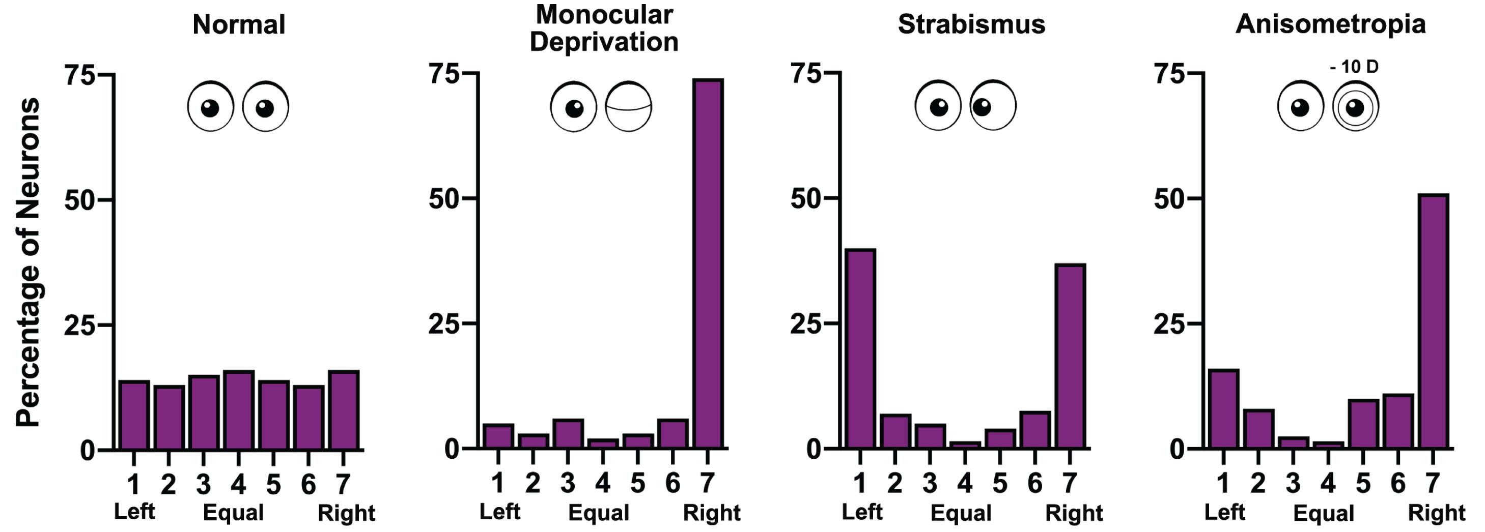 Fig. 11.11.2, Ocular Dominance Histograms Comparing the Effects of Different Conditions That Produce Amblyopia.