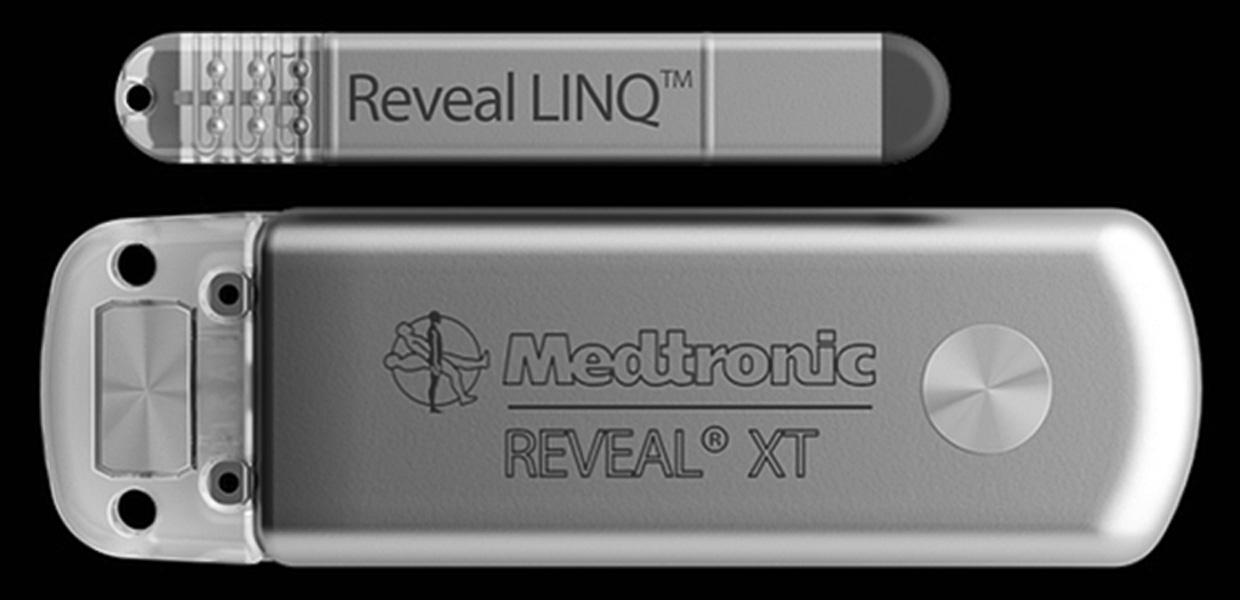 Fig. 6.2, Example of an older (lower image) and a more recent (upper image) generation implantable loop recorder (ILR). Note the more compact size of the newer ILR.