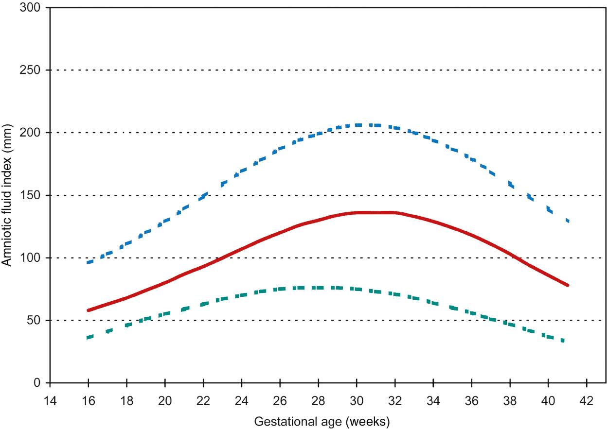 Fig. 24.2, Amniotic fluid index. Four quadrant sum of deepest vertical pockets (measured in millimeters). Solid line indicates the median values, upper and lower dashed lines are the 95th and 5th percentiles, respectively.