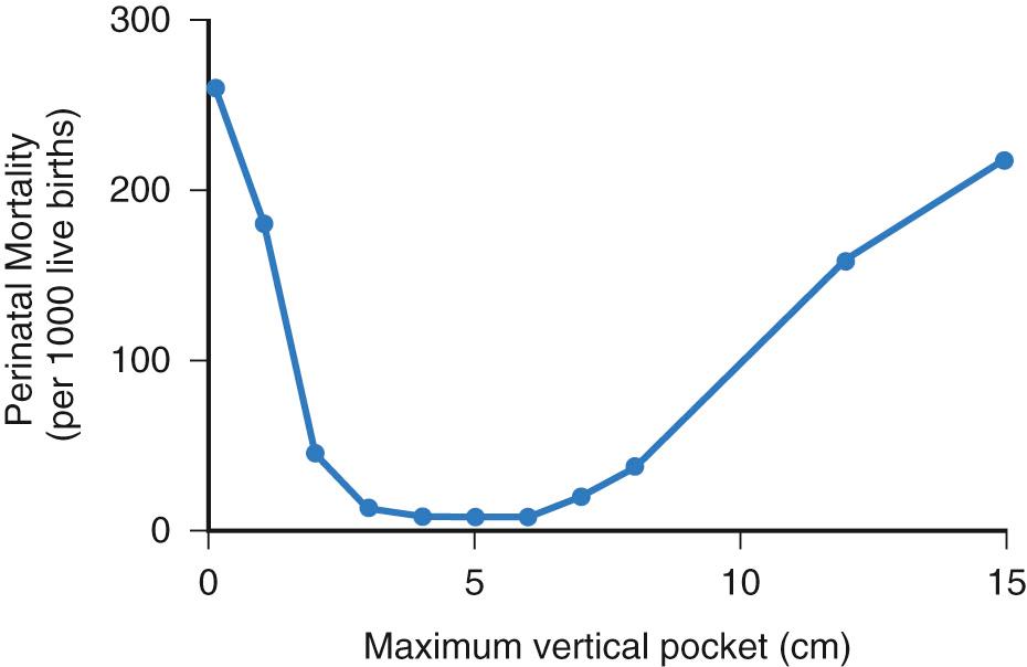 Fig. 24.5, Perinatal mortality rate related to maximum vertical pocket (MVP) measurements in centimeters. Note the increased perinatal mortality with MVP less than 2 or greater than 8 cm.