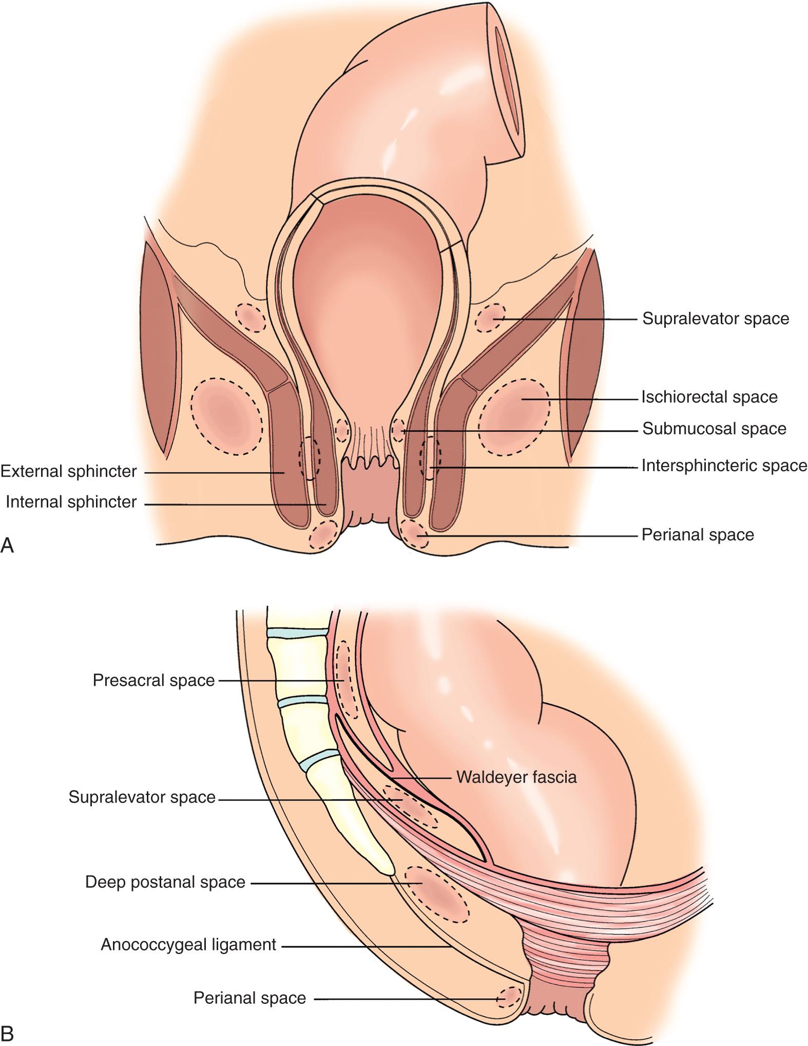 FIGURE 160.1, Classification of anorectal abscesses by location. (A) Coronal view. (B) Sagittal view.