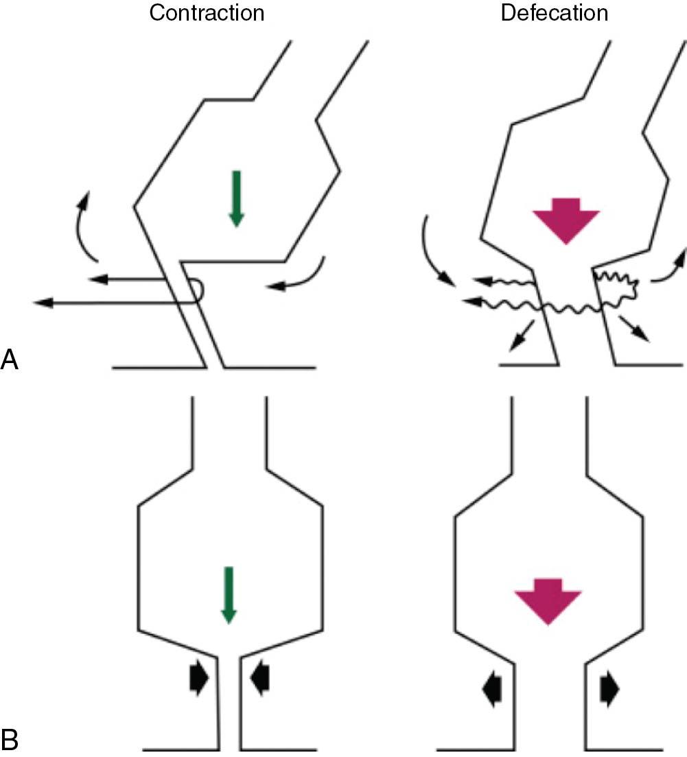 Fig. 22.2, Angulation between the rectum and the anal canal. A, Lateral view. B, Anteroposterior view.