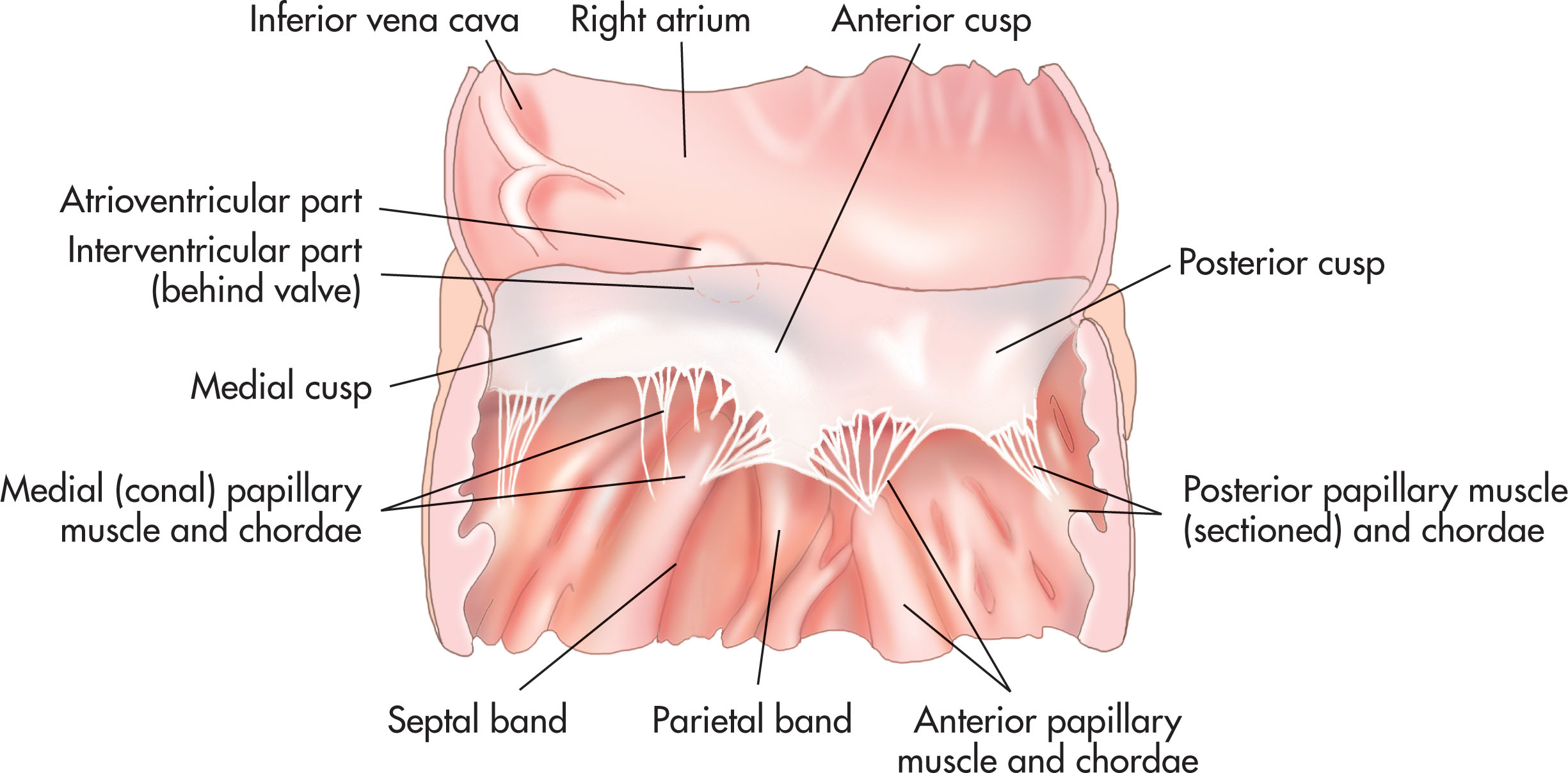 Fig. 30.15, The tricuspid valve has three leaflets: anterior, septal, and inferior (or mural).