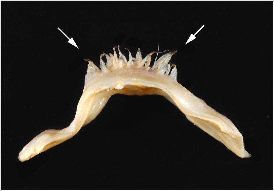 Figure 2.14, Lambl excrescences. These finger-like projections exhibit simple or no branching and arise exclusively along the closing surface (distal to the line of closure) of the valve.