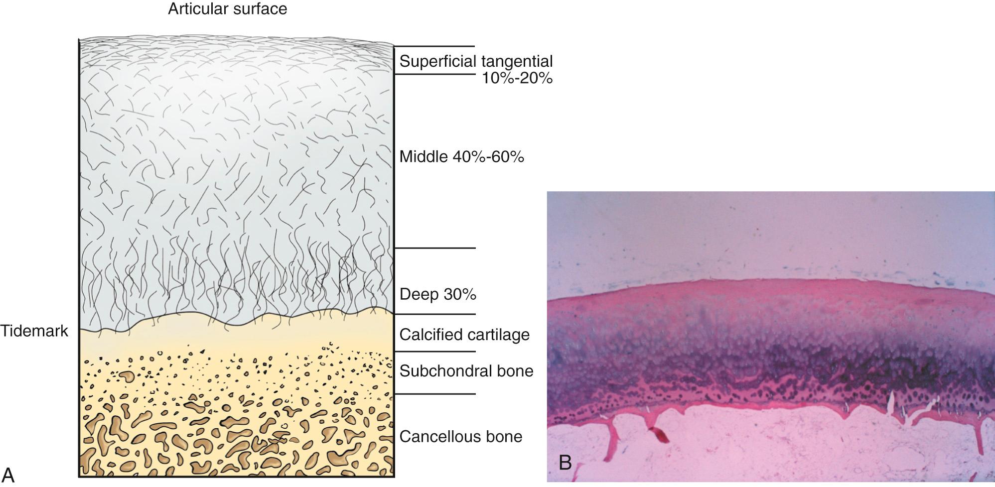 FIG 1.13, (A) Diagrammatic representation of the transition from articular cartilage to bone. (B) Normal articular (hyaline) cartilage composed of water, collagen, and proteoglycan. The sparsely cellular, smooth superficial zone becomes increasingly cellular in deeper layers. A distinct basophilic line, the mineralization front, can be seen where cartilage becomes calcified.