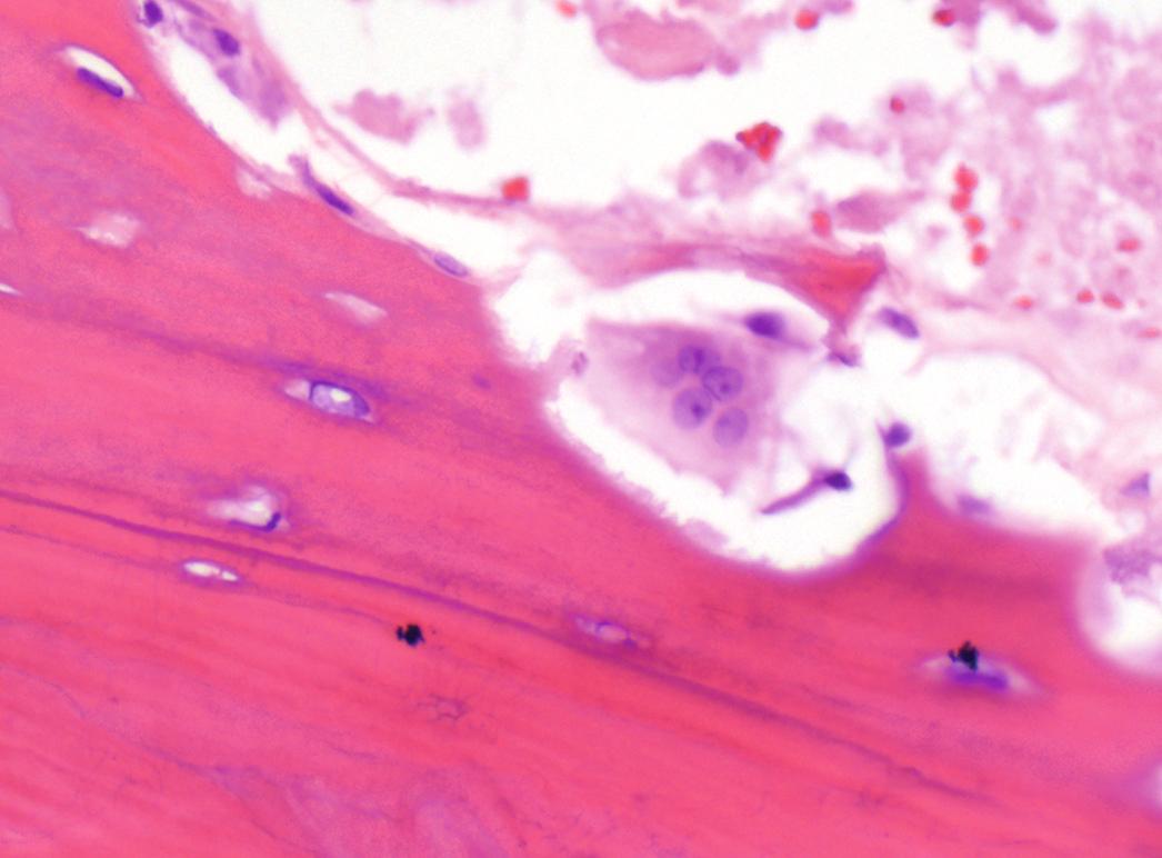 FIG 1.2, Osteoclast