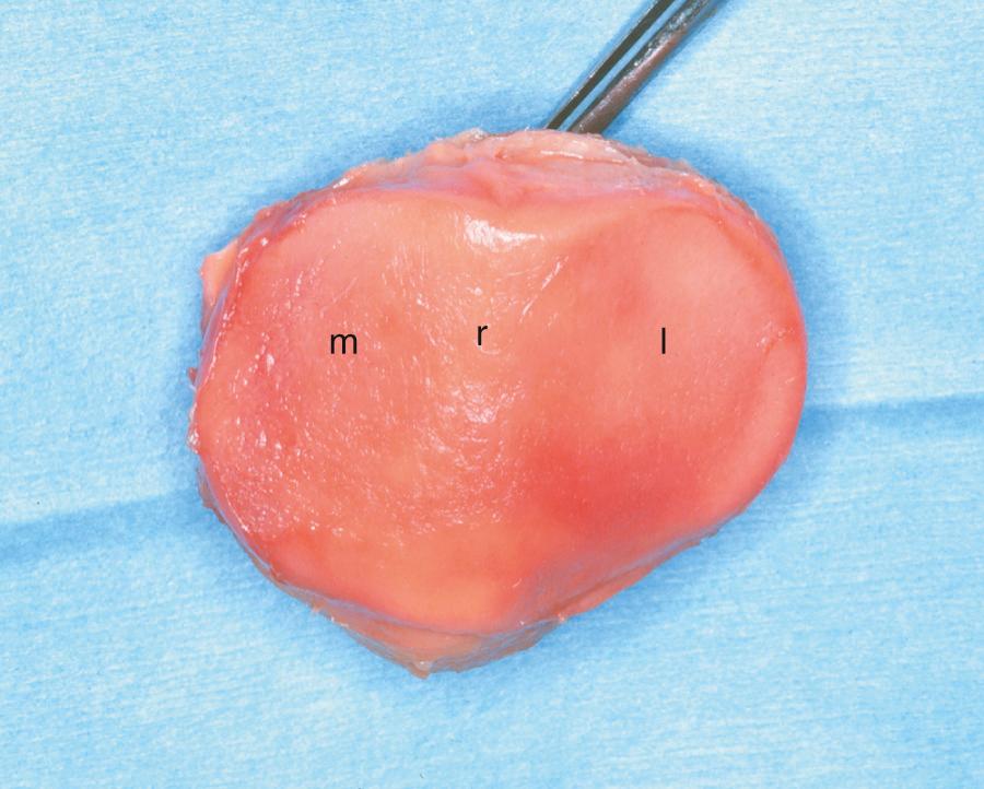 FIG 1.5, Articular Surface of the Patella