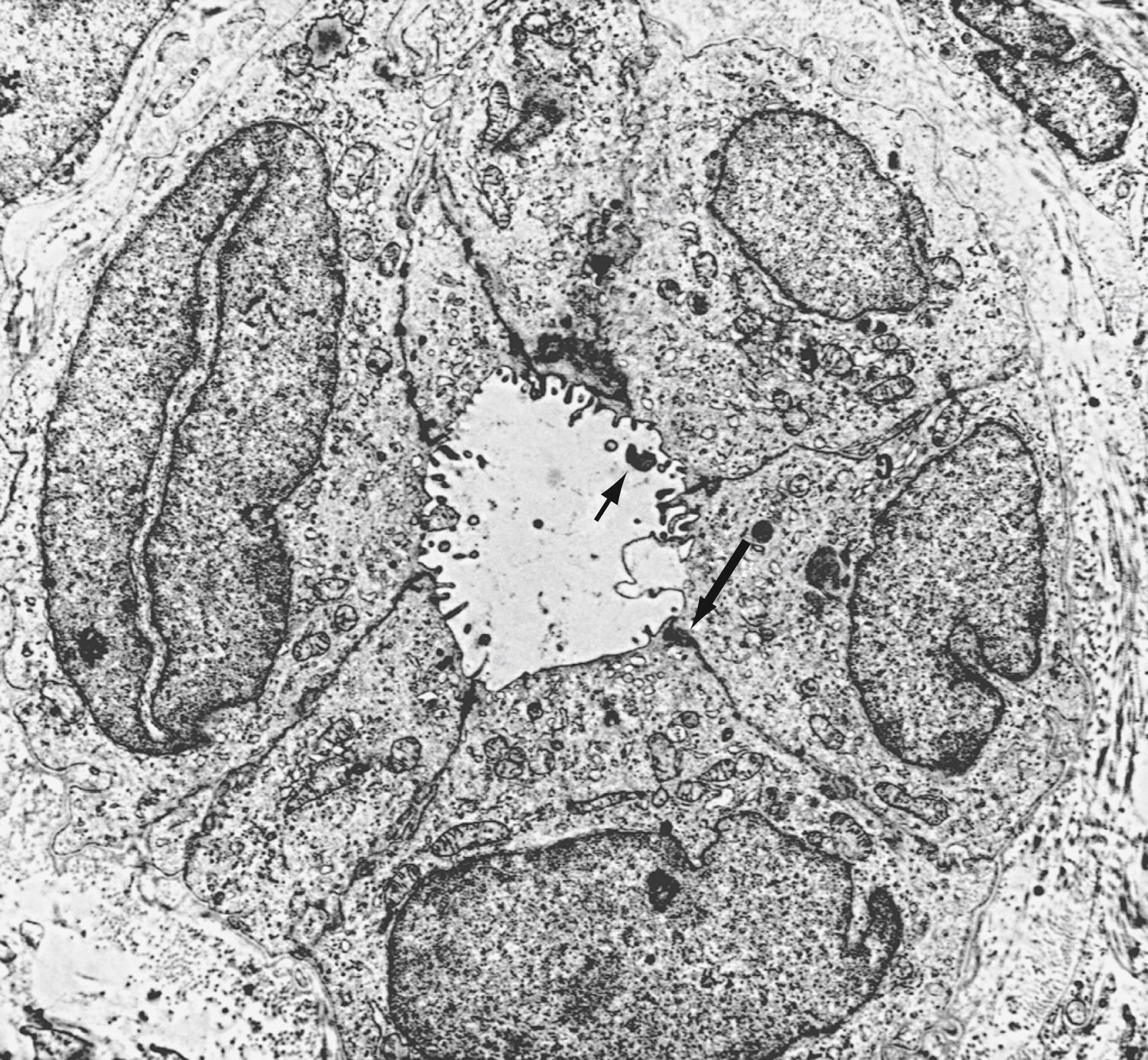 Fig. 62.2, Ultrastructure of an interlobular bile duct.