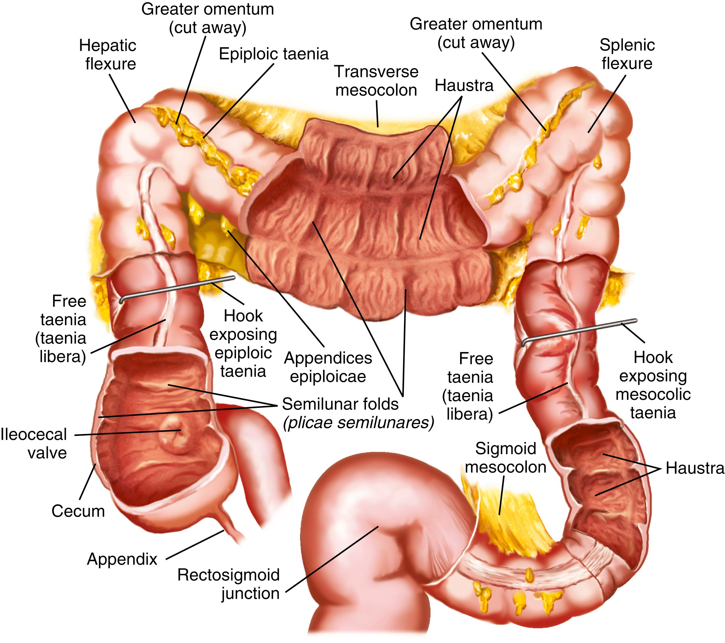 Fig. 98.1, Macroscopic characteristics of the colon. Note the taeniae, haustra between the taeniae, the semilunar folds, and the appendices epiploicae.