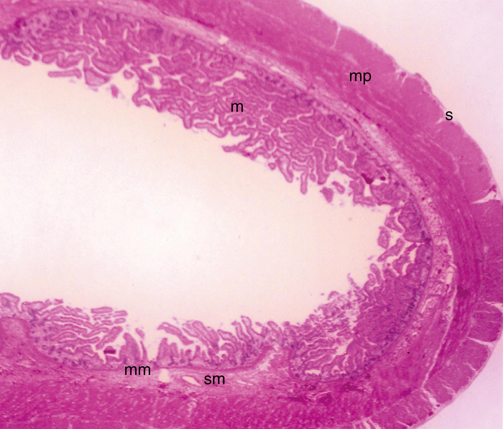 Fig. 98.2, Photomicrograph of small intestine showing its general microscopic architecture. m , Mucosa; mm , muscularis mucosae; mp , muscularis propria; s , serosa; sm , submucosa. (H&E, ×25.)