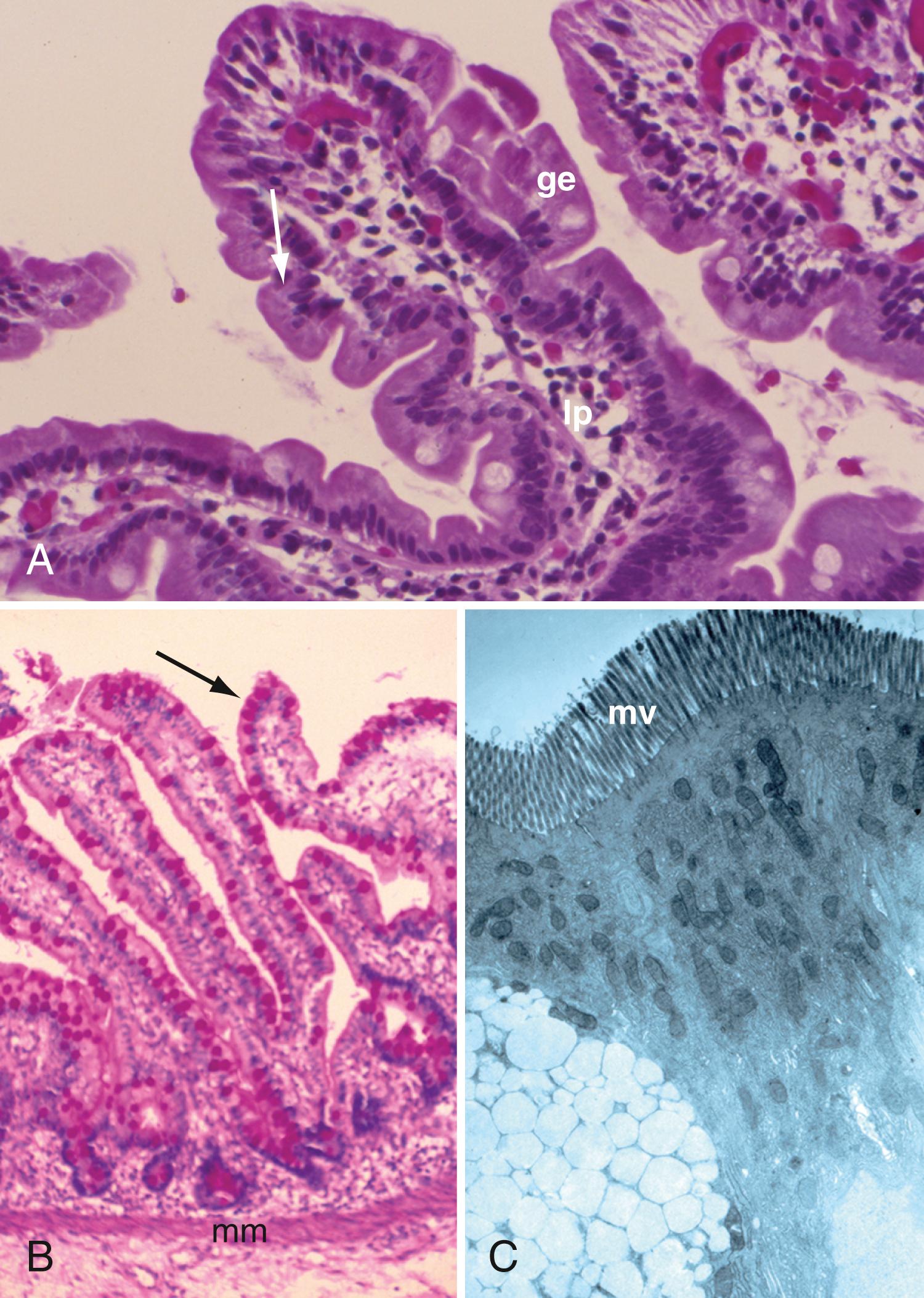Fig. 98.3, Histologic and electron microscopic photographs of small intestine. A, Components of the mucosa: ge , glandular epithelium; lp , lamina propria. Note the absorptive cells that appear as high columnar cells with eosinophilic cytoplasm ( arrow ). (H&E, ×250.) B, Goblet cells ( arrow ) and brush border are stained red. mm , Muscularis mucosae. (Periodic acid–Schiff stain, ×150.) C, Microvilli ( mv ) are seen as delicate finger-like projections on electron microscopic examination, ×9000.