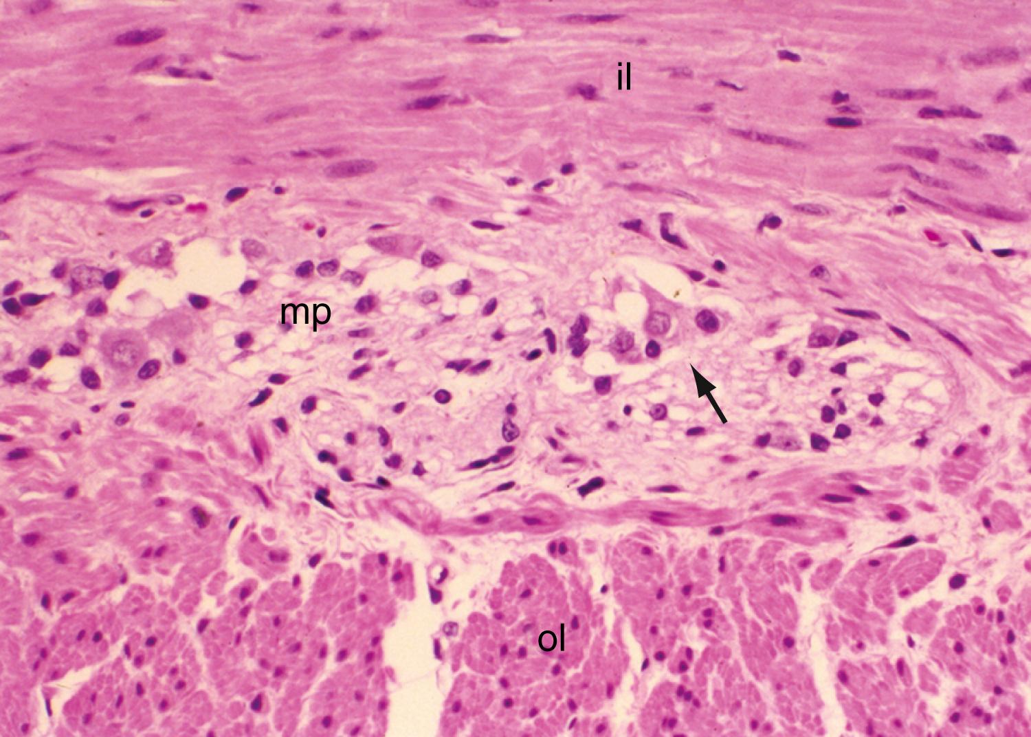 Fig. 98.8, Photomicrograph of muscularis propria of small intestine. The myenteric plexus ( mp ) is seen as a pale area with ganglion cells between the inner and outer layers ( il, ol ) of the muscularis propria ( arrow ). (H&E, ×250.)