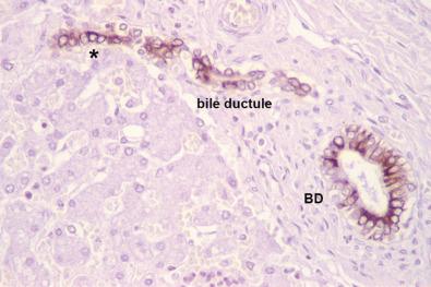 Fig. 1-12, Biliary structures in the portal tract, highlighted by cytokeratin 19 immunostaining.