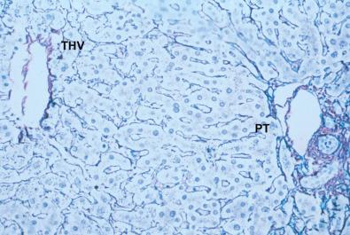 Fig. 1-4, Normal hepatic microarchitecture.