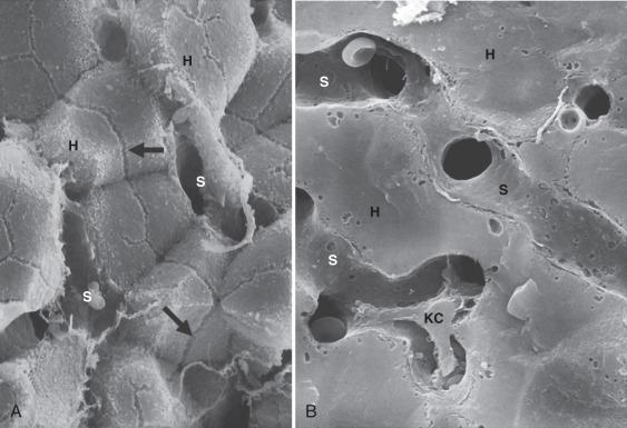 Fig. 1-5, Plates of hepatocytes (H) viewed by scanning electron microscopy.