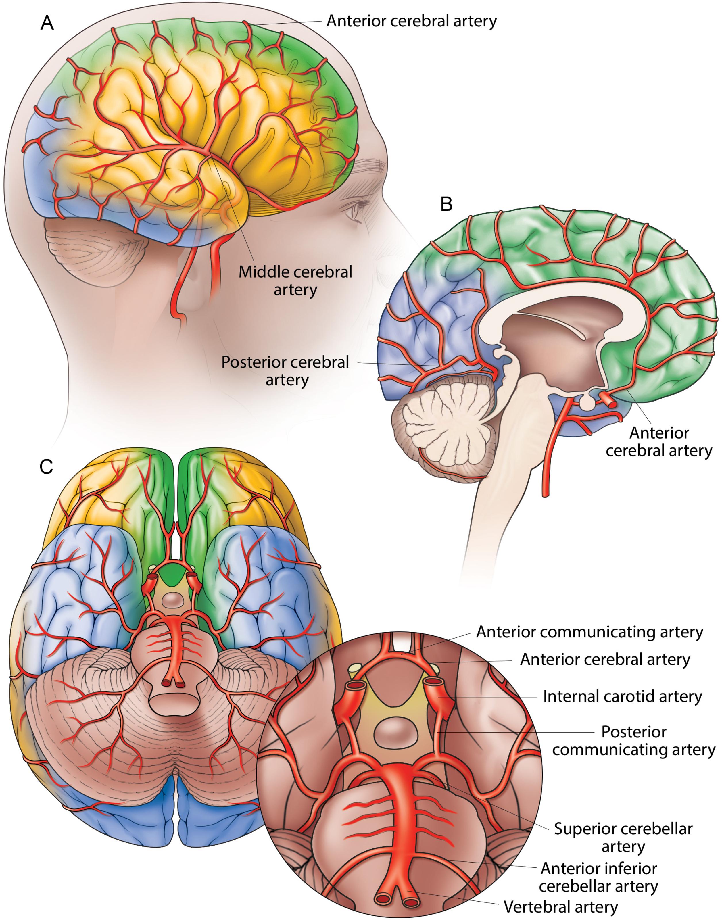 Fig. 1.3, Vascularization of the brain. The shading indicates the arterial supply territories of the anterior ( green ), middle ( yellow ), and posterior ( blue ) cerebral arteries. ( A ) Lateral view. The middle cerebral artery supplies most of the lateral surface of the cerebral hemisphere, excluding the superior portion of the parietal lobe, which is supplied by the anterior cerebral artery, and the occipital and inferior portions of the temporal lobe, which are supplied by the posterior cerebral artery. ( B ) Midline sagittal view. Branches of the anterior cerebral artery, the frontal arteries, supply the paracentral lobule, medial frontal and cingulate gyri, and the corpus callosum. The posterior cerebral artery supplies the posteromedial surface of the temporal lobe and the occipital lobe. The visual cortex, responsible for the contralateral field of vision, is also supplied by the posterior cerebral artery. ( C ) Inferior view. The posterior cerebral artery also supplies the inferior temporal lobe. Orbital branches of the anterior cerebral artery supply the frontal lobe, olfactory cortex, medial orbital gyrus, and gyrus rectus. The lateral frontobasal artery, a branch of the middle cerebral artery, supplies the lateral part of the inferior surface of the frontal lobe as well as the inferior frontal gyrus. The circle of Willis is formed anteriorly by the left and right anterior cerebral arteries, connected to each other by the anterior communicating artery, and posteriorly by the left and right posterior cerebral arteries. The anterior and posterior circulation are connected by the left and right posterior communicating arteries.