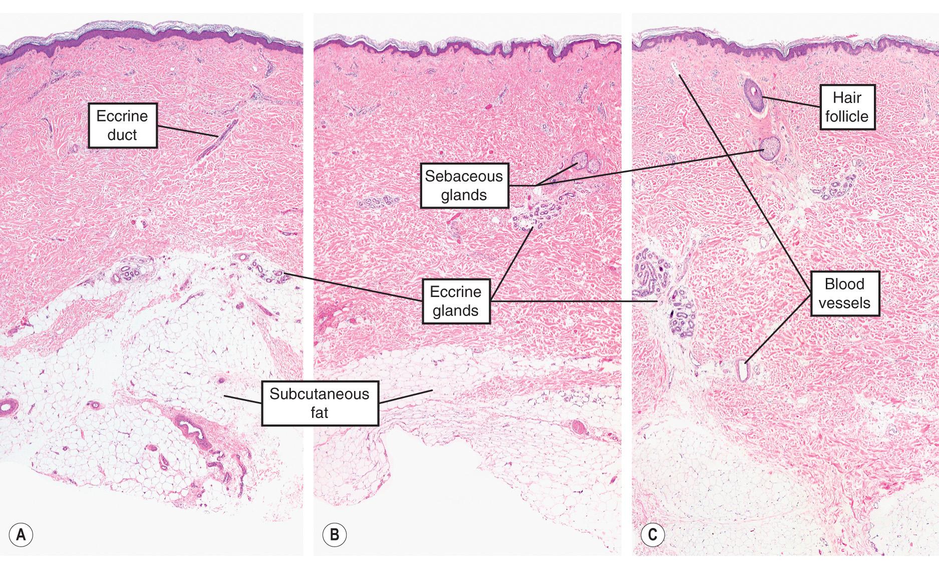 Fig. 1.2, Histopathologic features of normal skin from three different anatomic sites.