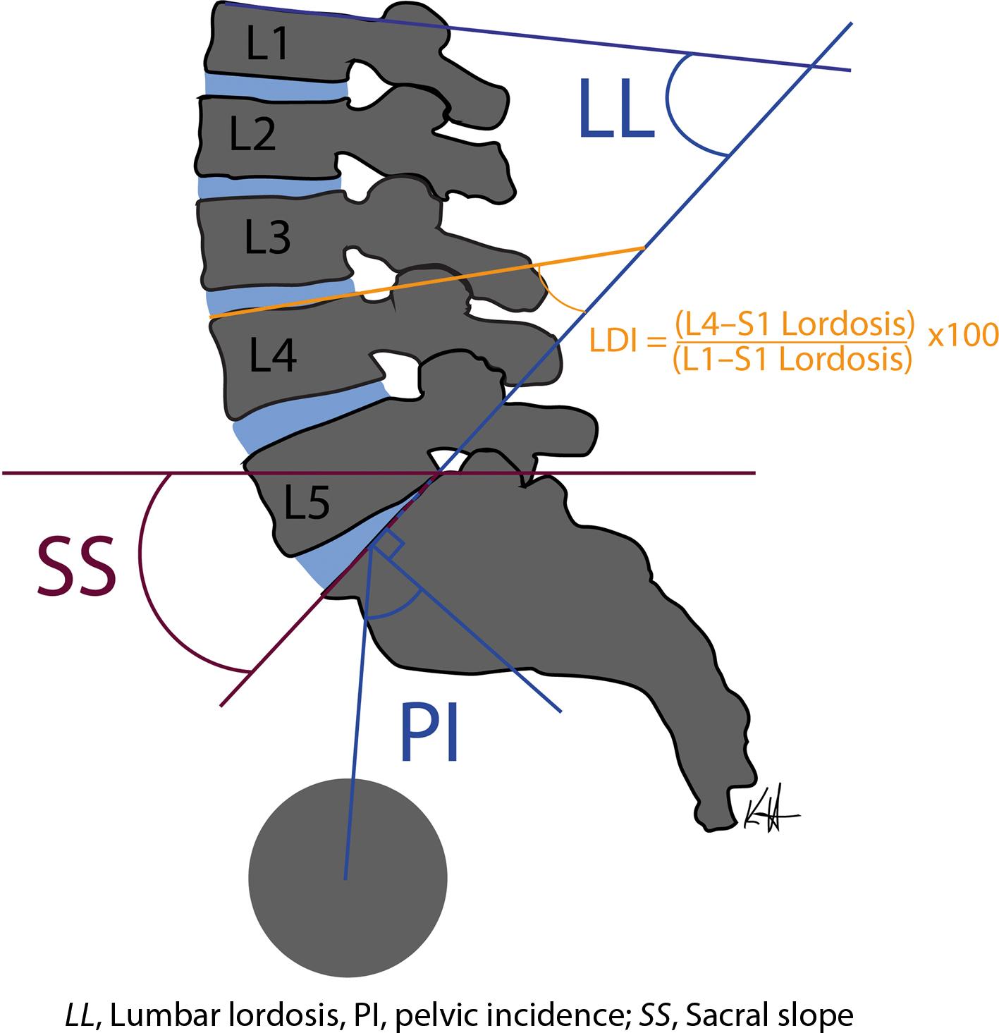 Fig. 1.3, Lumbar angles of interest.