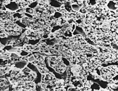 Figure 1-3, Scanning electron micrograph of rat femoral marrow. The hematopoietic cells are grouped between the interlacing network of vascular sinuses. Many cells are dislodged when the marrow is transected, and separate spaces are present where cells had been.