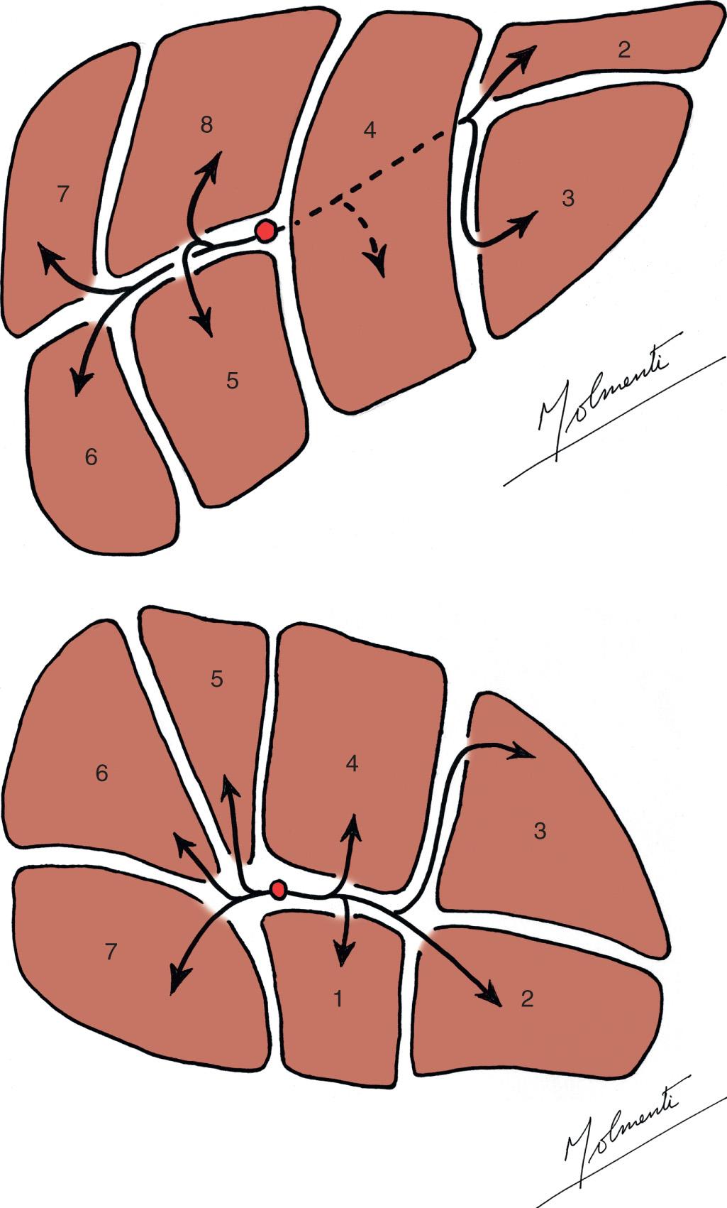 FIGURE 118.3, Schematic representation of the arteriobiliary liver anatomy.