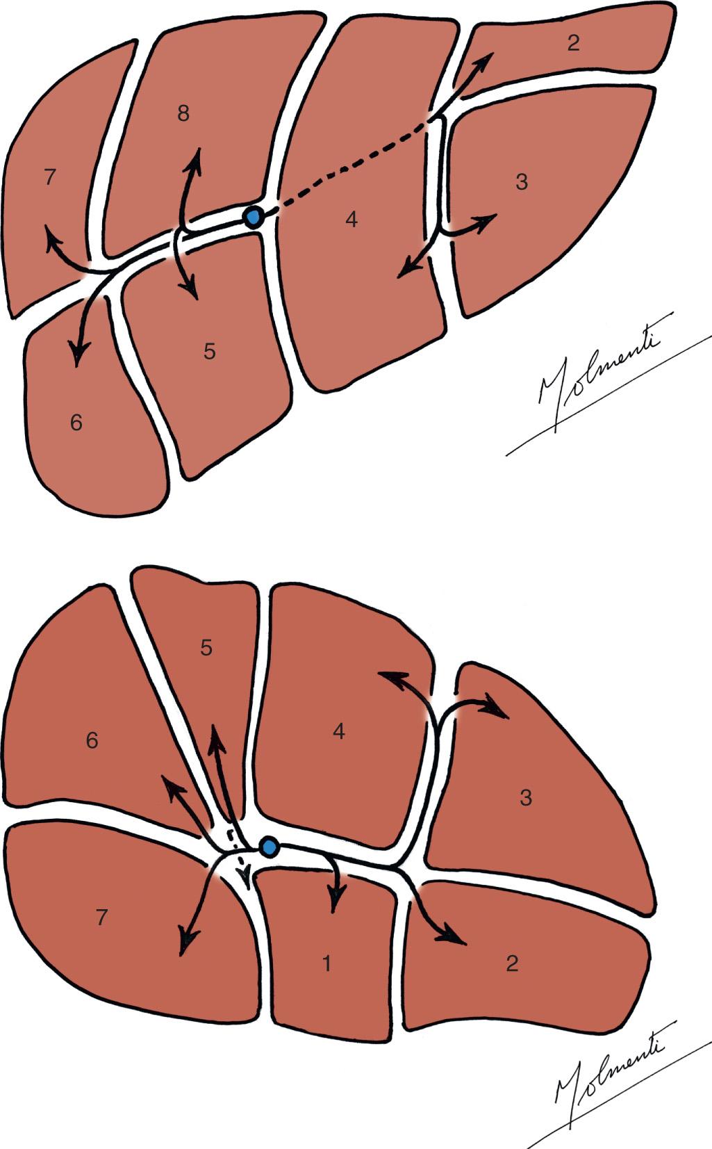 FIGURE 118.4, Schematic representation of the portal venous liver anatomy.