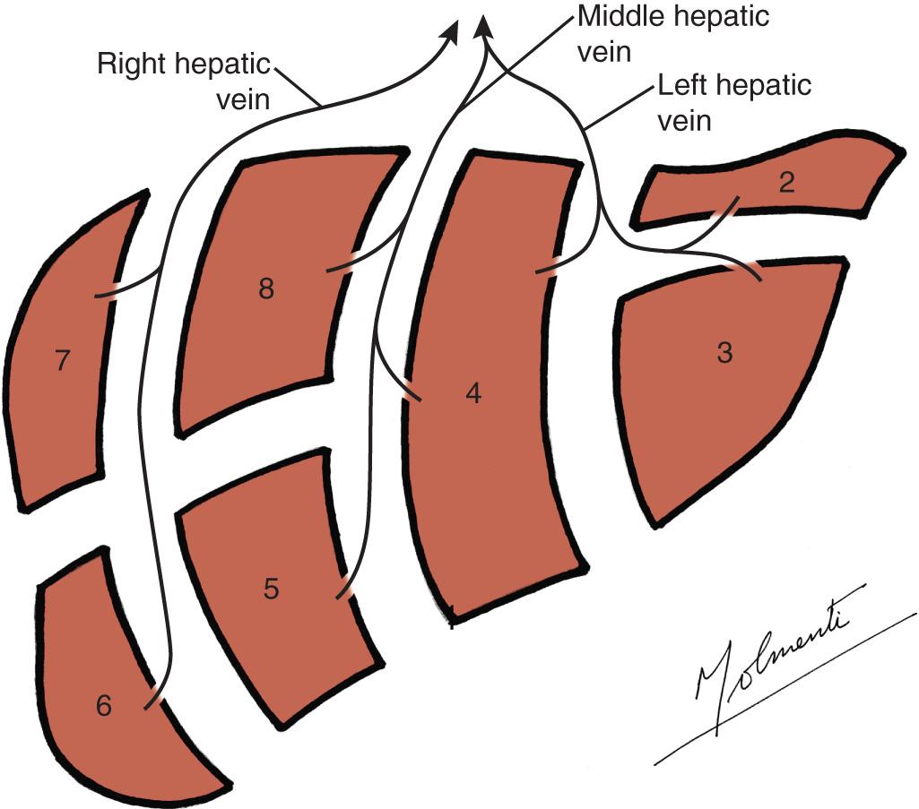 FIGURE 118.5, Schematic representation of the hepatic venous liver anatomy.