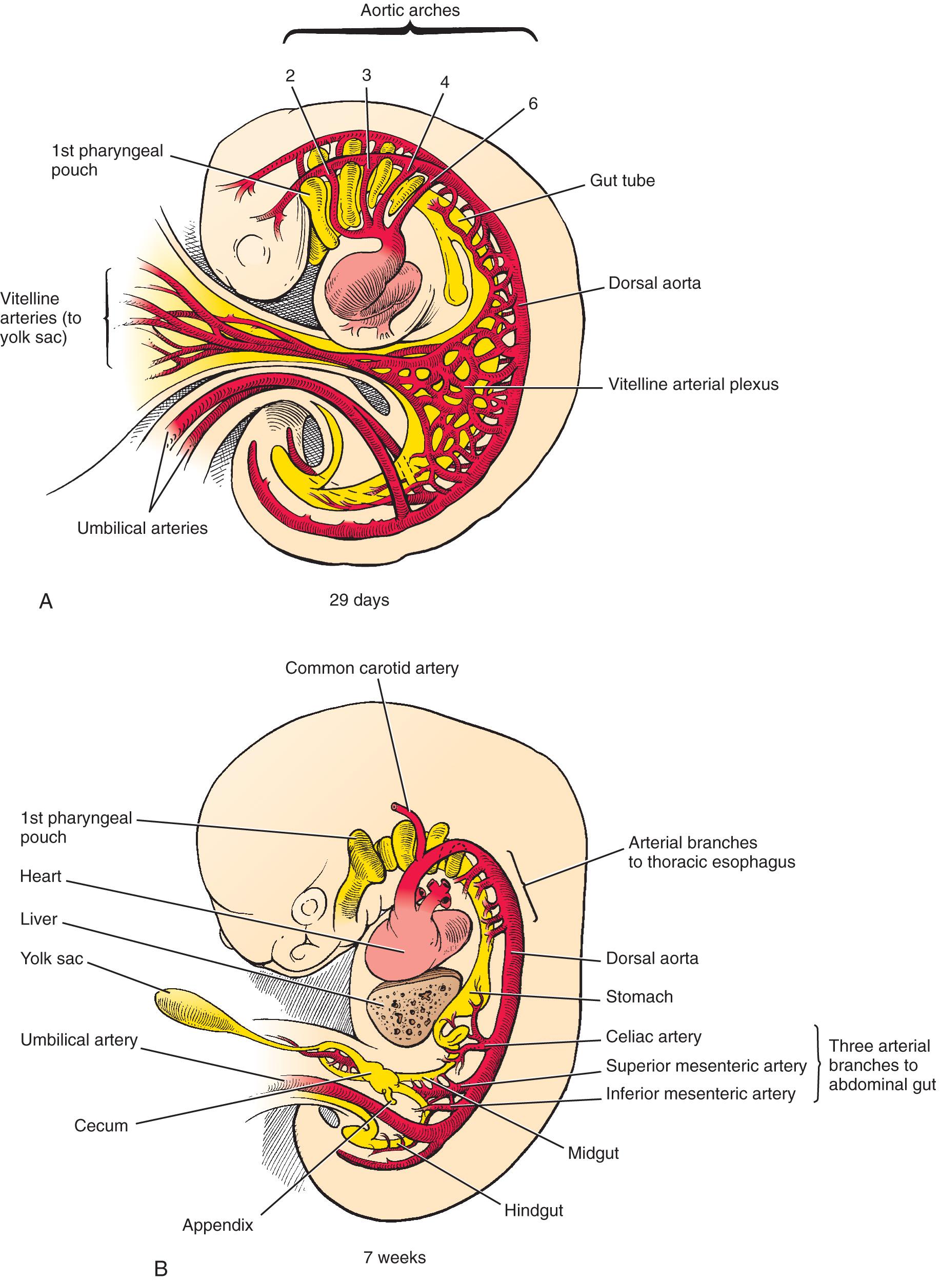 FIGURE 86.1, Development of the three arterial trunks. (A) Several vitelline arteries between the aorta and the yolk sac. (B) Vitelline arteries reduced in number to approximately five in the thoracic region and three in the abdominal region.