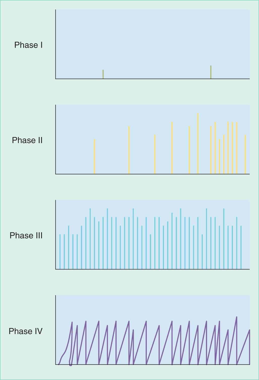 FIGURE 71.12, Diagrammatic representation of the four phases of the migratory motor complex. Amplitudes versus time are displayed.