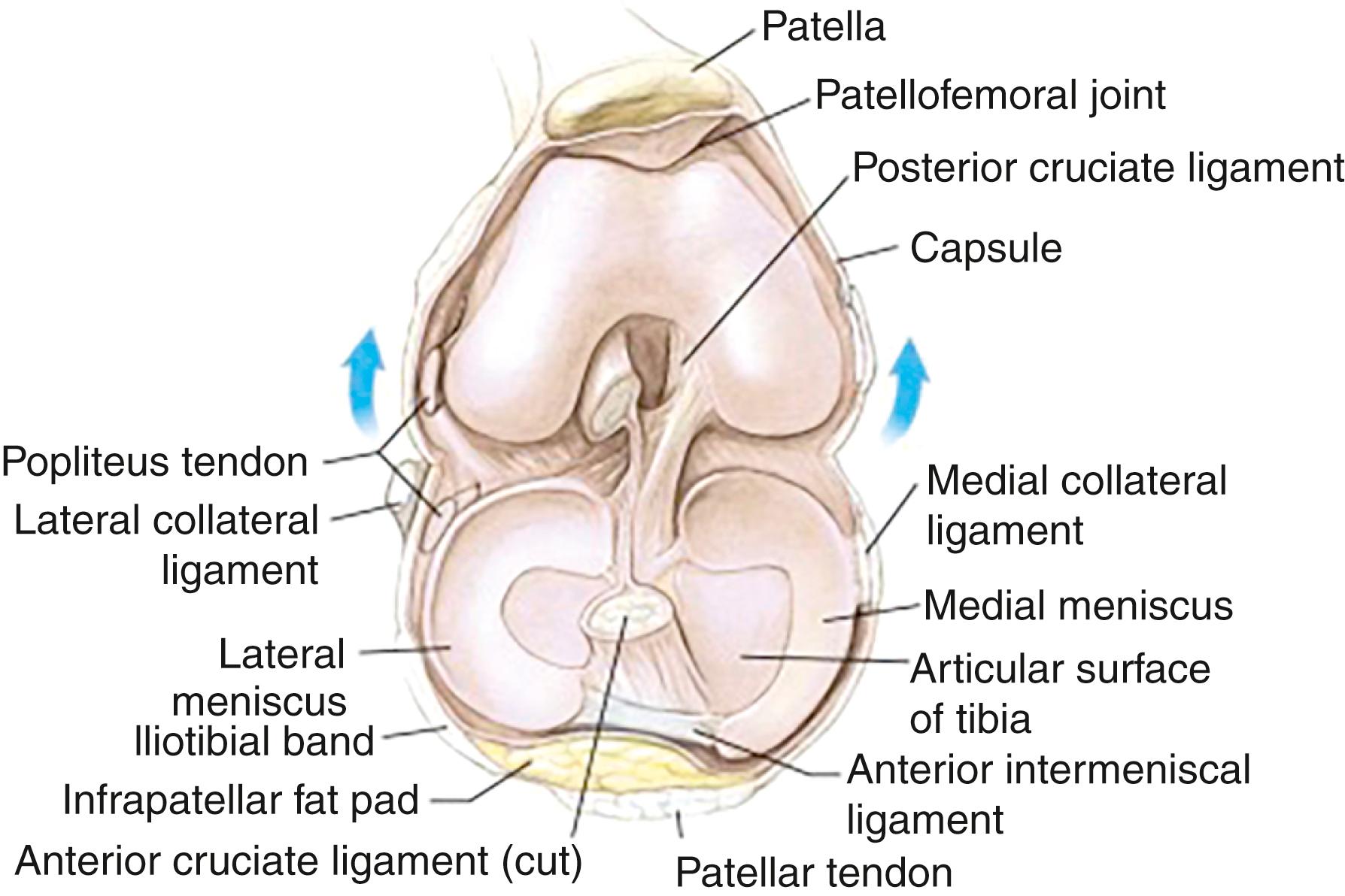 Fig. 1.2, Knee joint (hinged open).