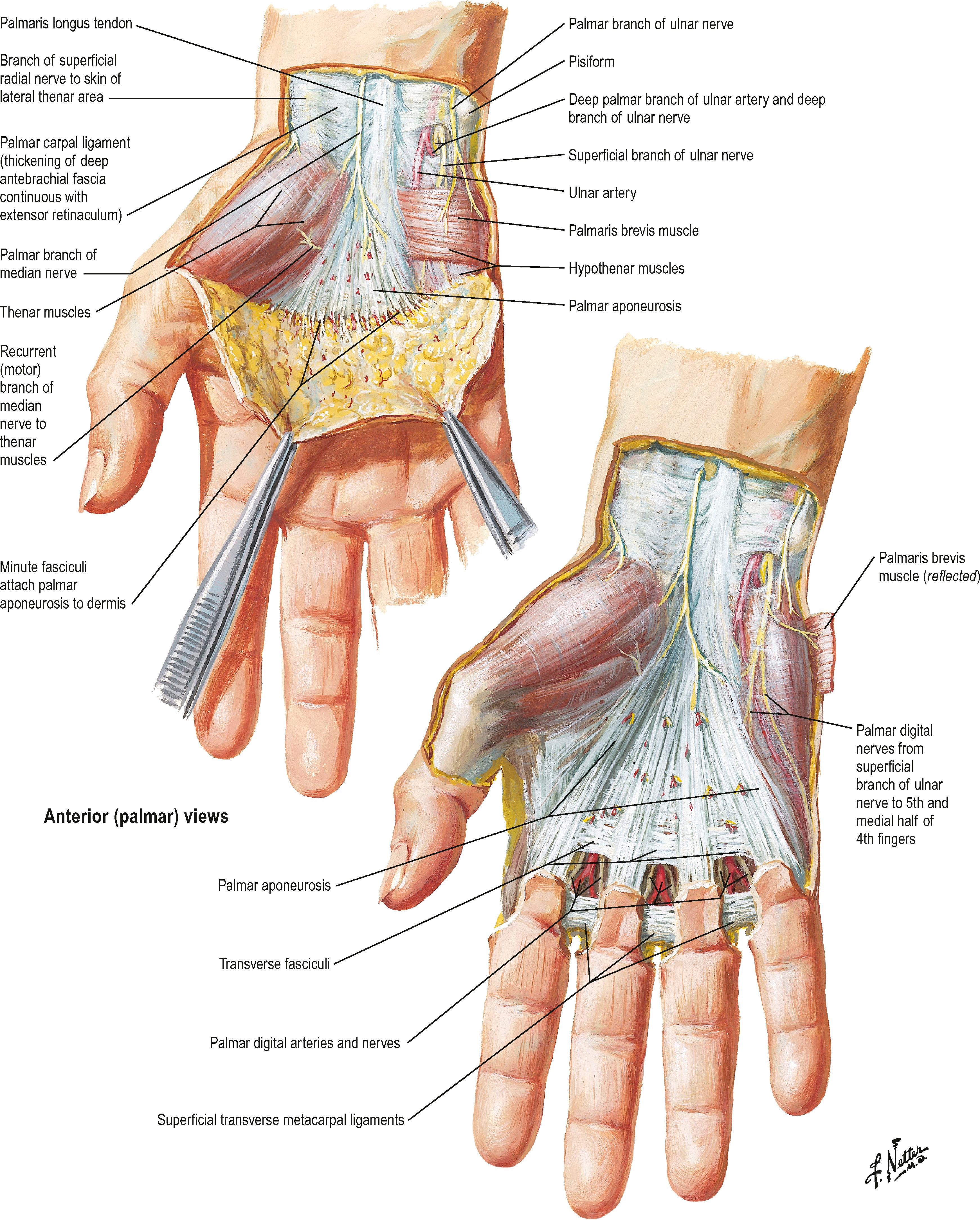 Figure 1.3, Superficial dissection of the palm, showing orientation of the palmar fascia.