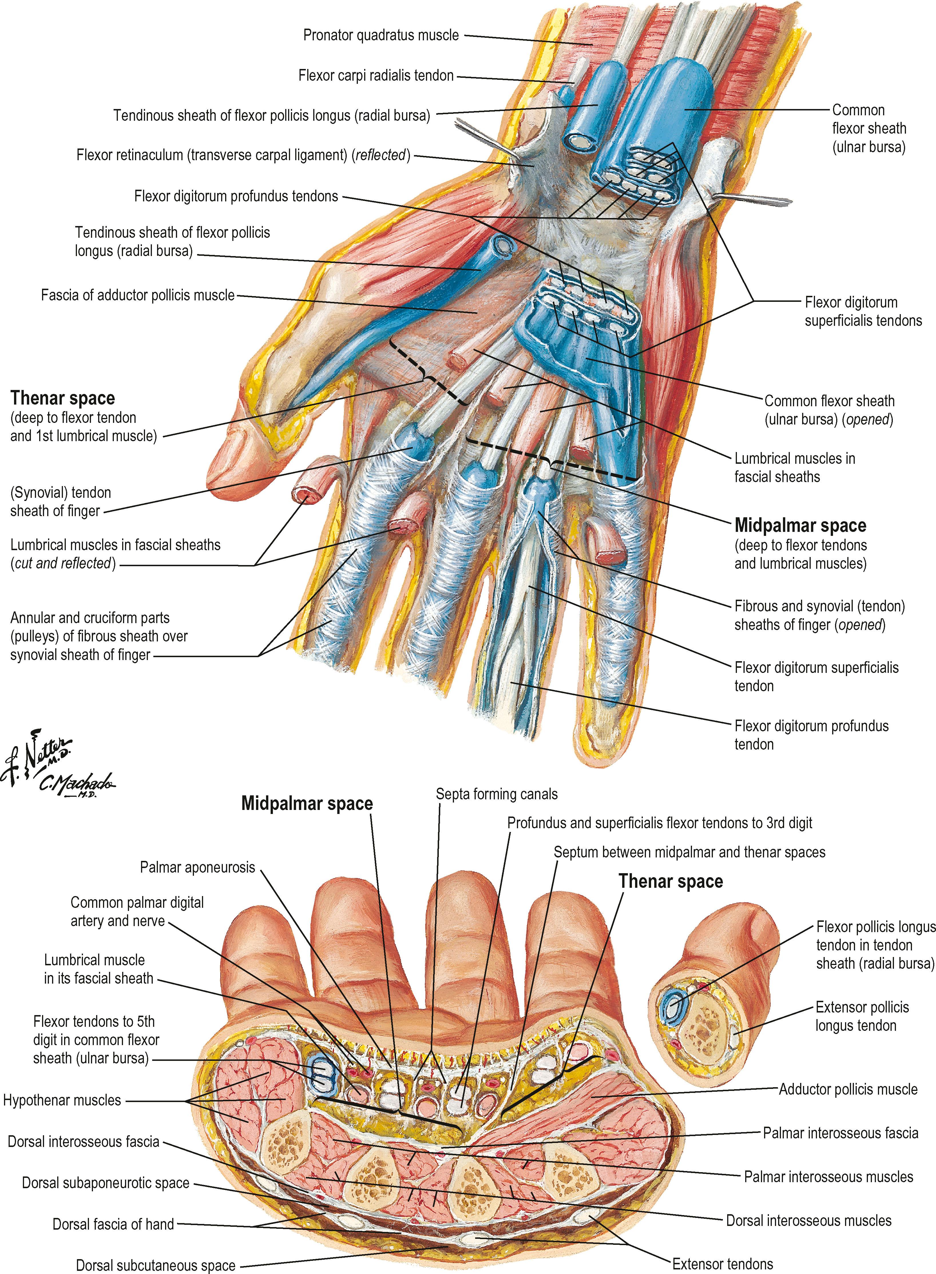 Figure 1.5, These deep palmar and midpalmar axial views of the hand reinforce the concept of distinct anatomic compartments separated by fascia.