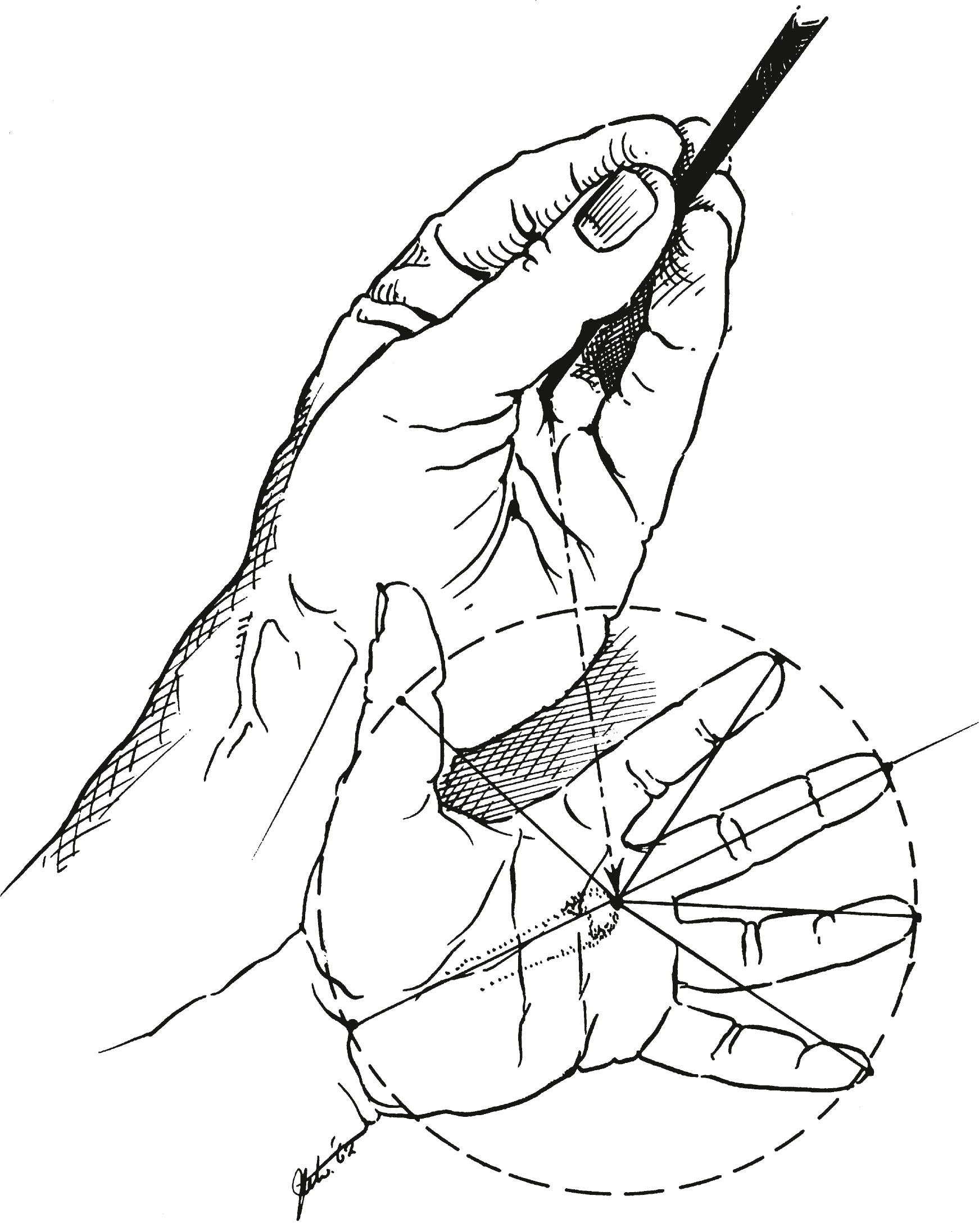Figure 1.8, When the adaptive arch is semicircular, the fingers converge in a cone over the anatomic center of the hand – the long-finger metacarpophalangeal joint.